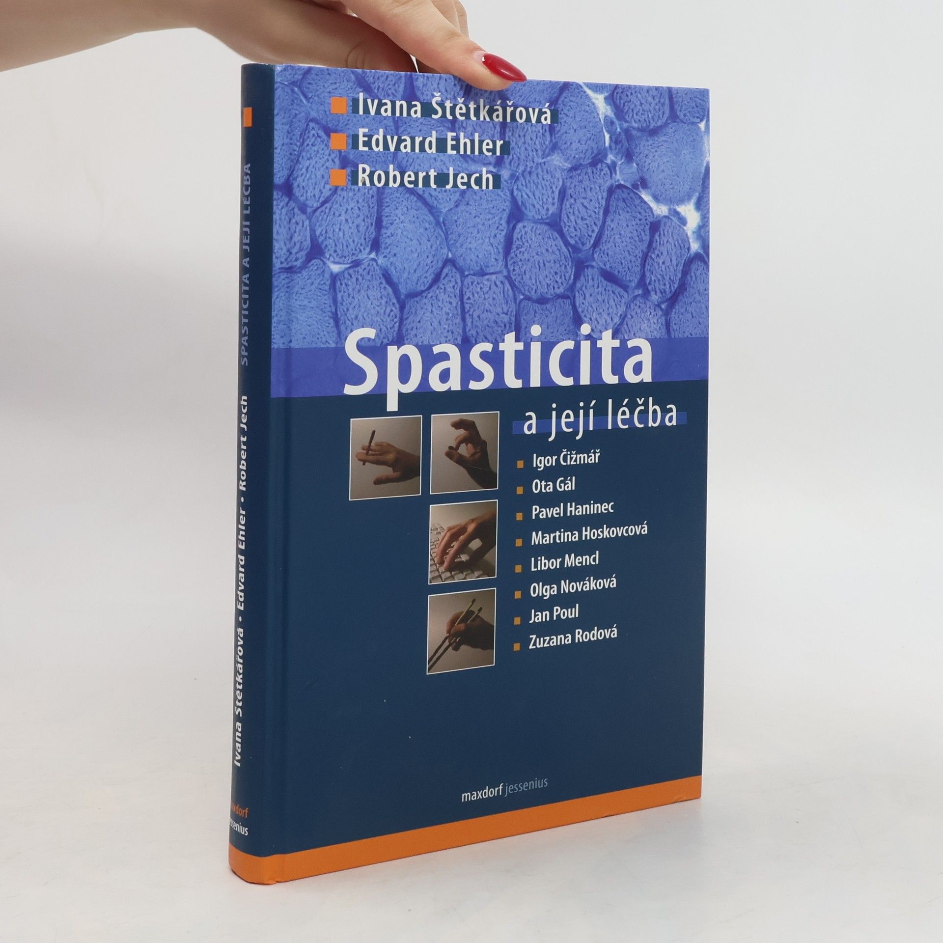 Ivana Štětkářová Spasticita a její léčba