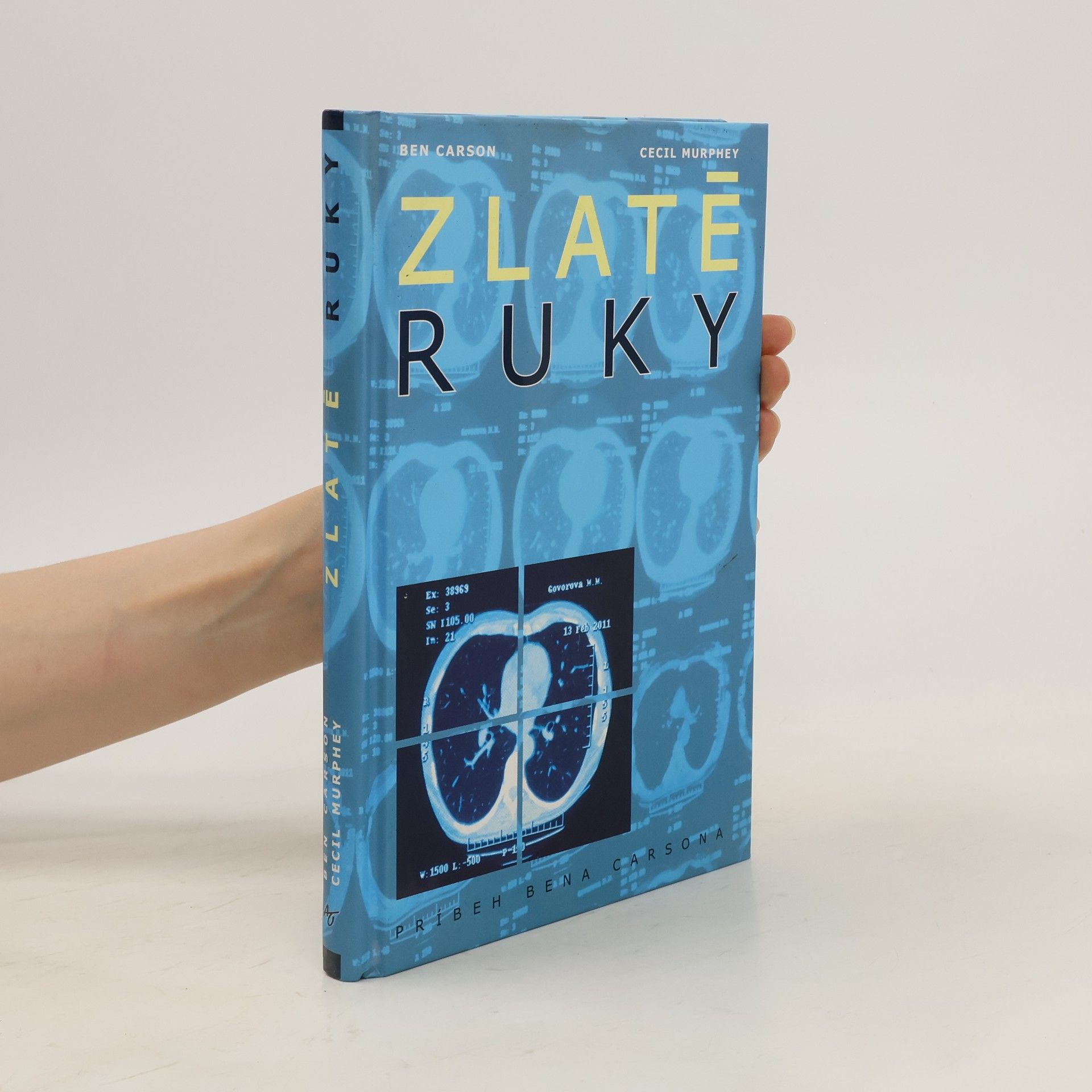 Carson Murphey Zlaté ruky