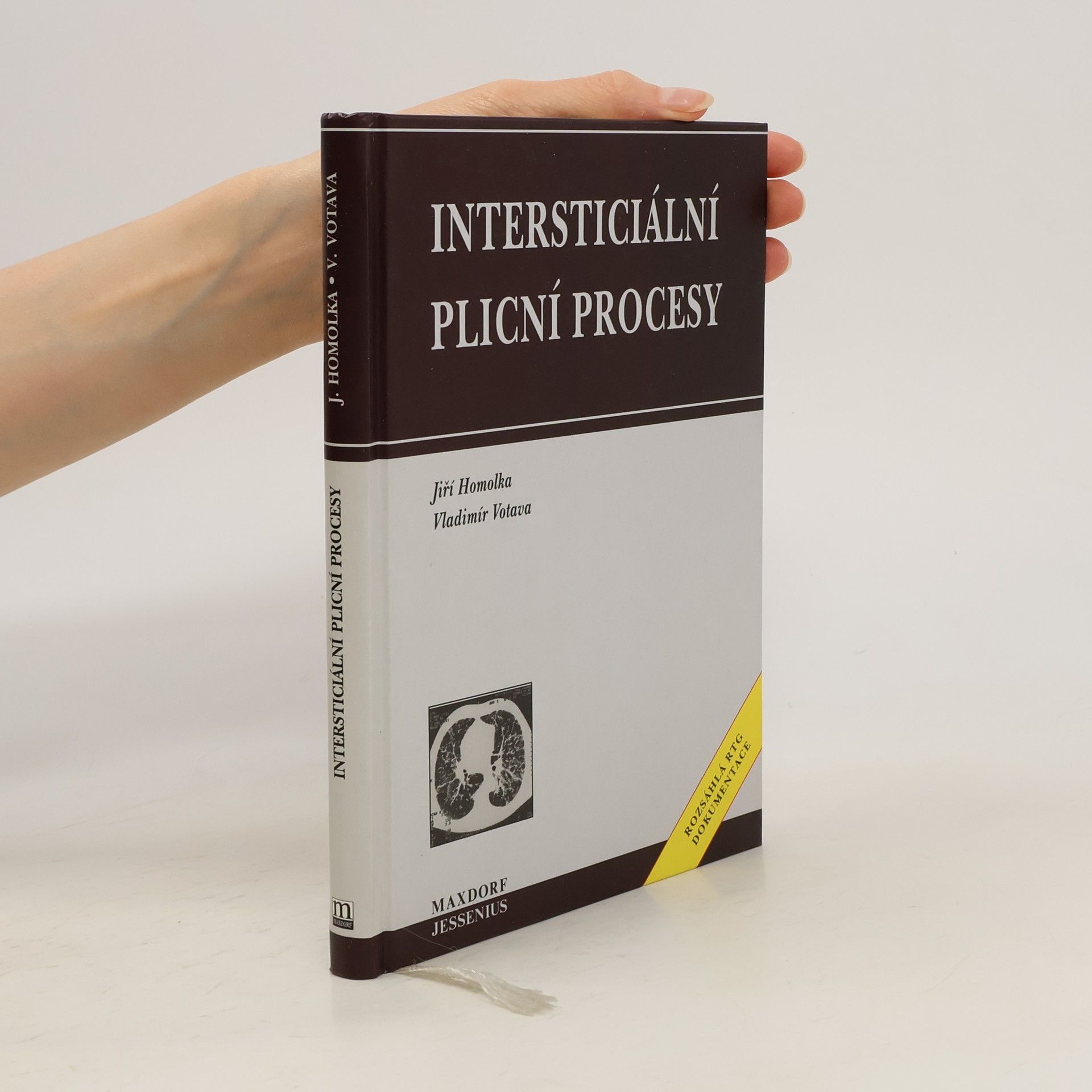 Jiří Homolka Intersticiální plicní procesy