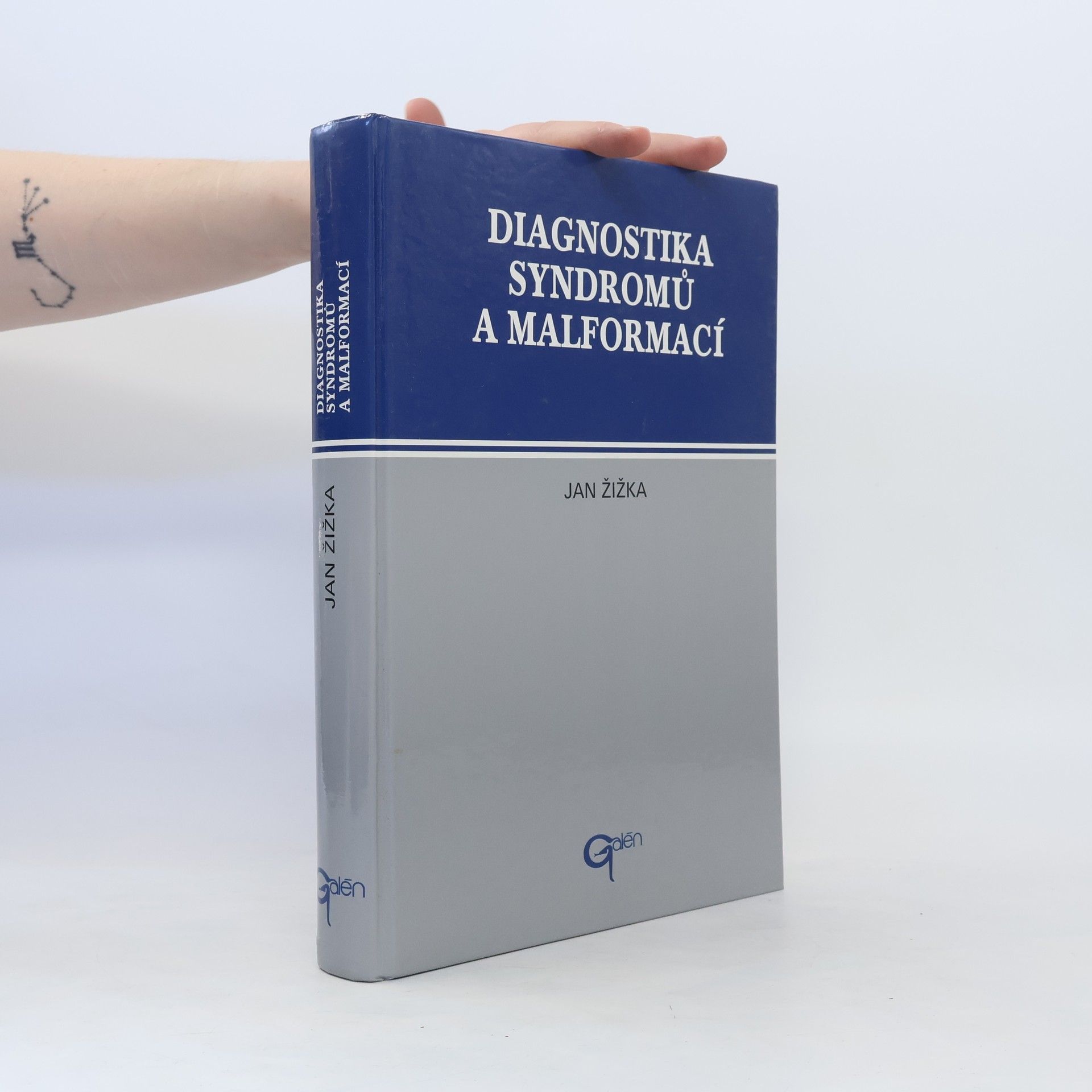Jan Žižka Diagnostika syndromů a malformací