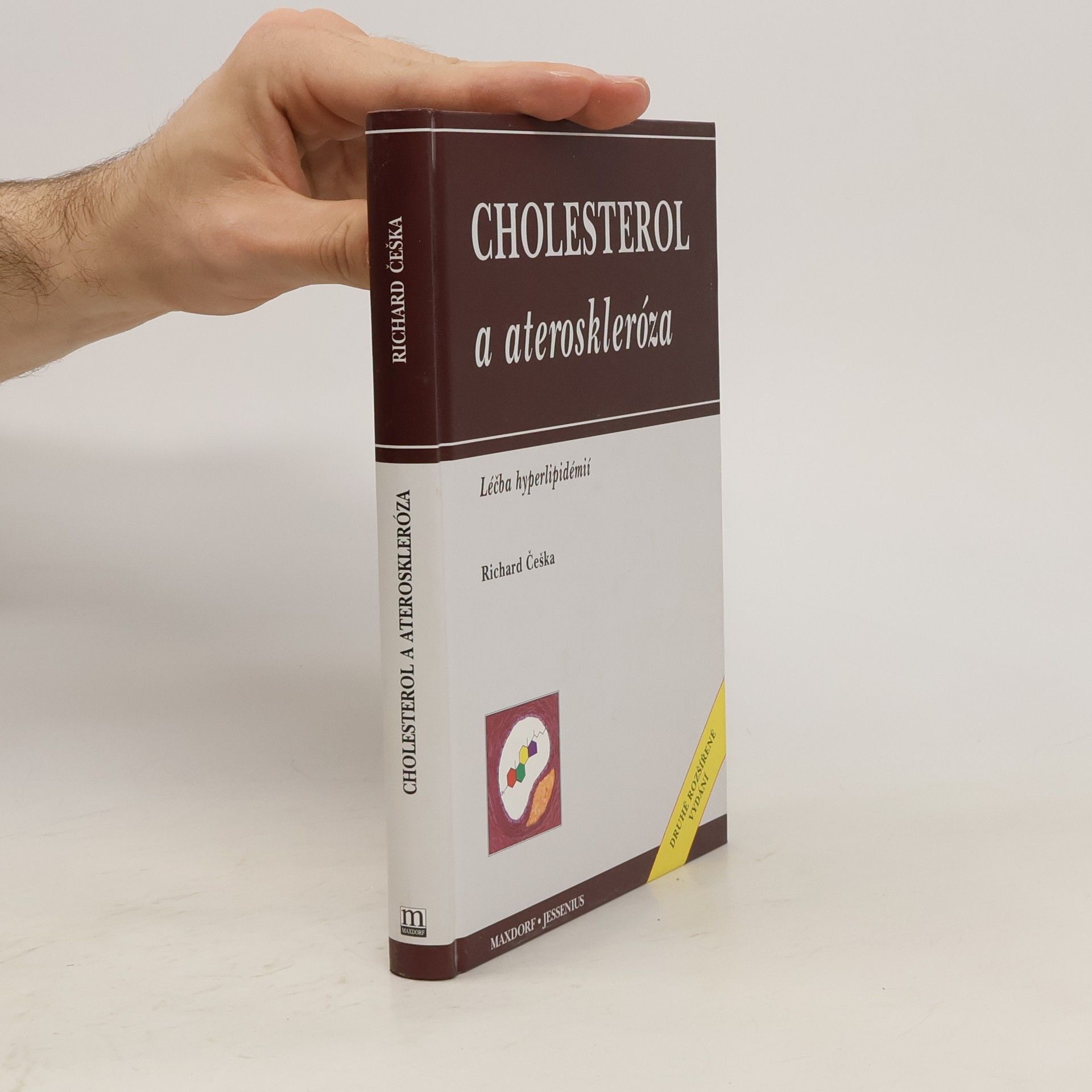 Richard Češka Cholesterol a ateroskleróza: Léčba hyperlipidémií