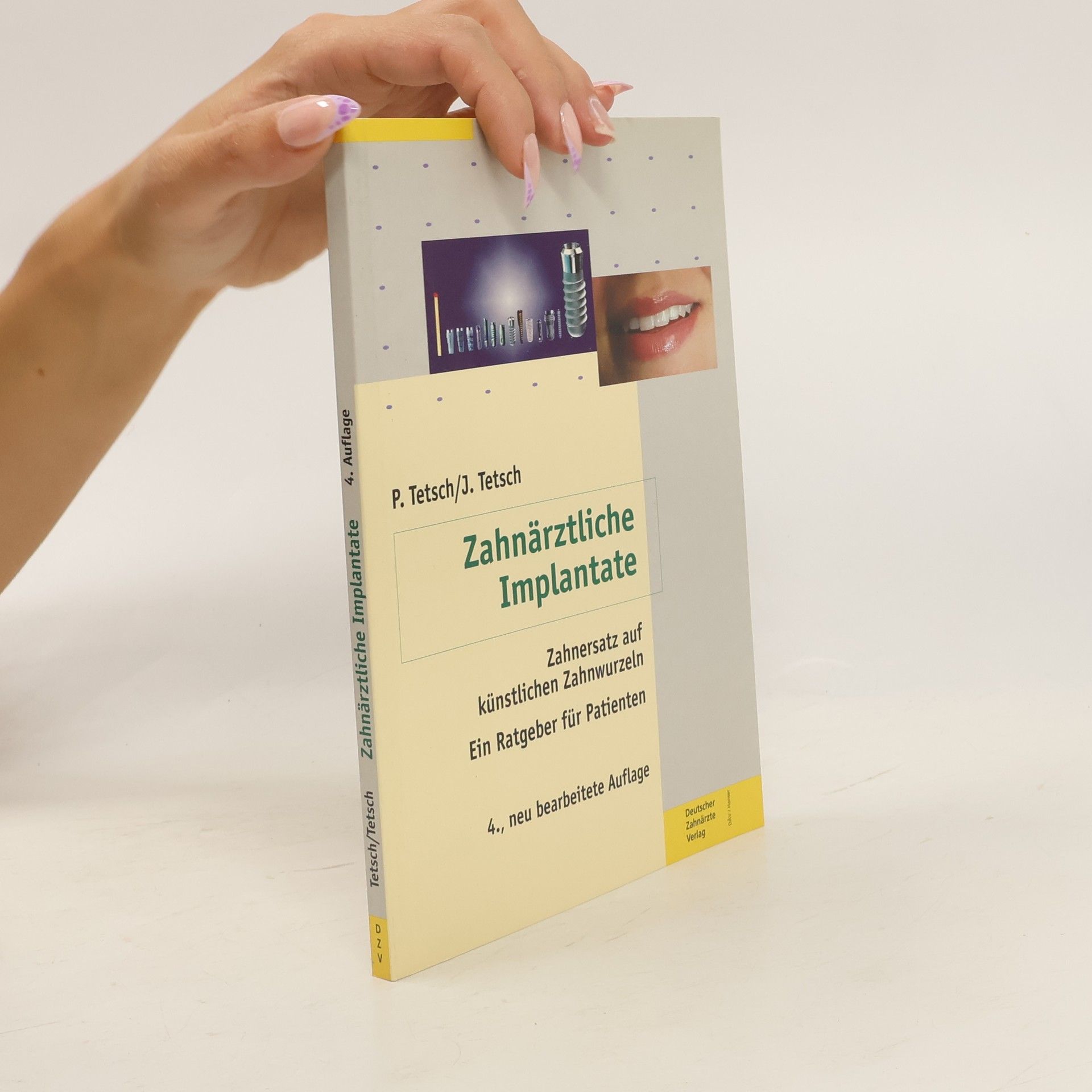 Zahnärztliche Implantate