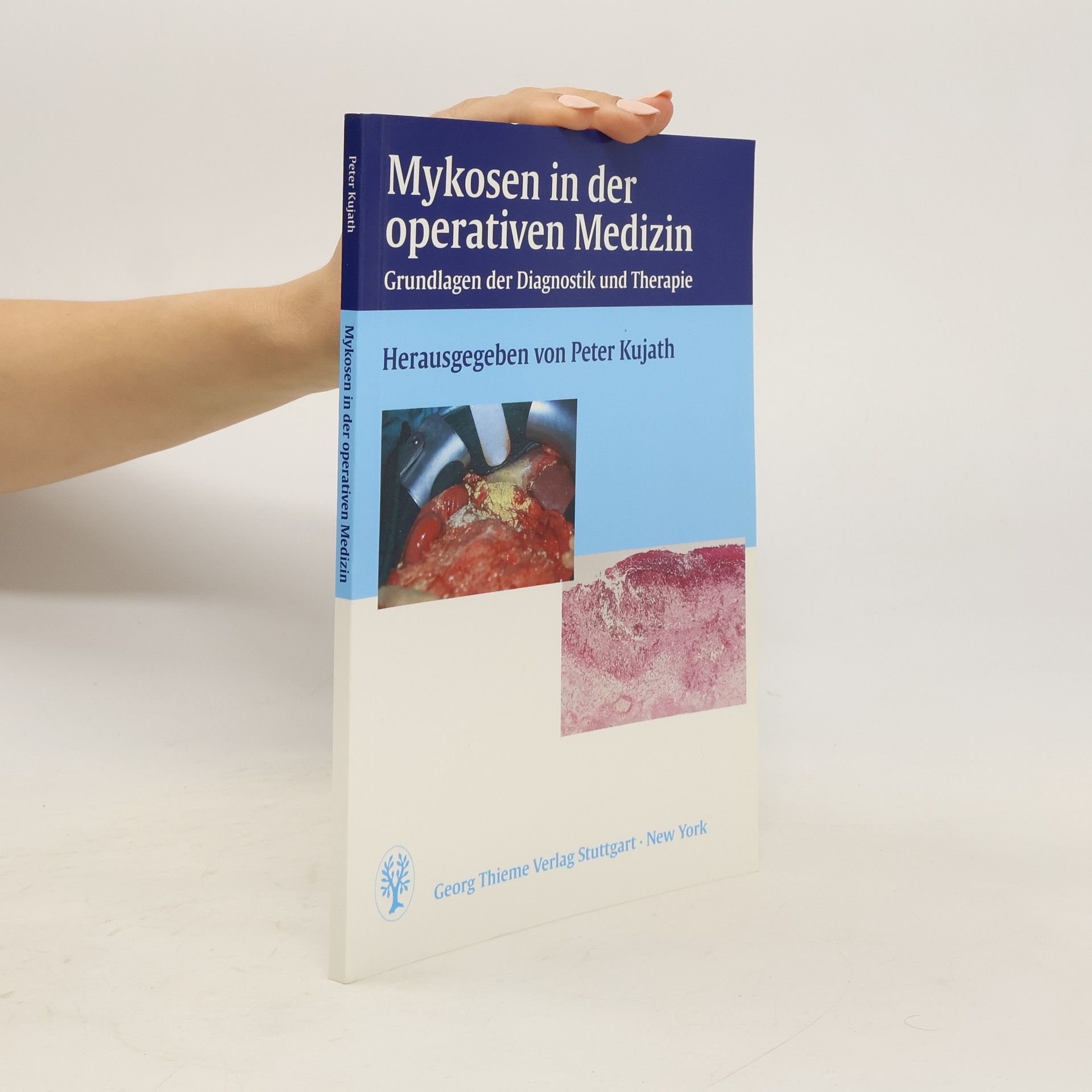 Peter Kujath Mykosen in der operativen Medizin