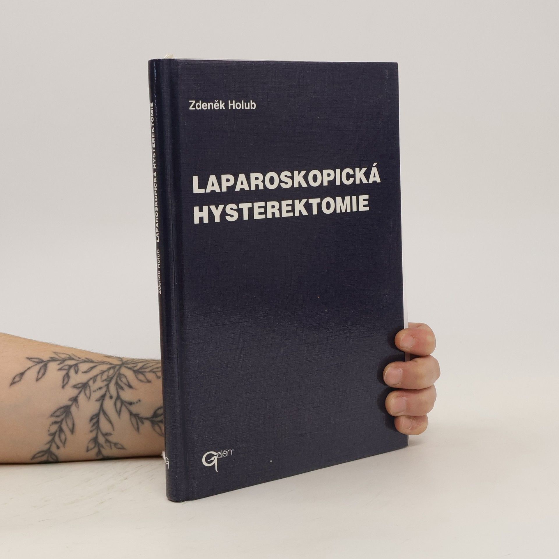 Zdeněk Holub Laparoskopická hysterektomie