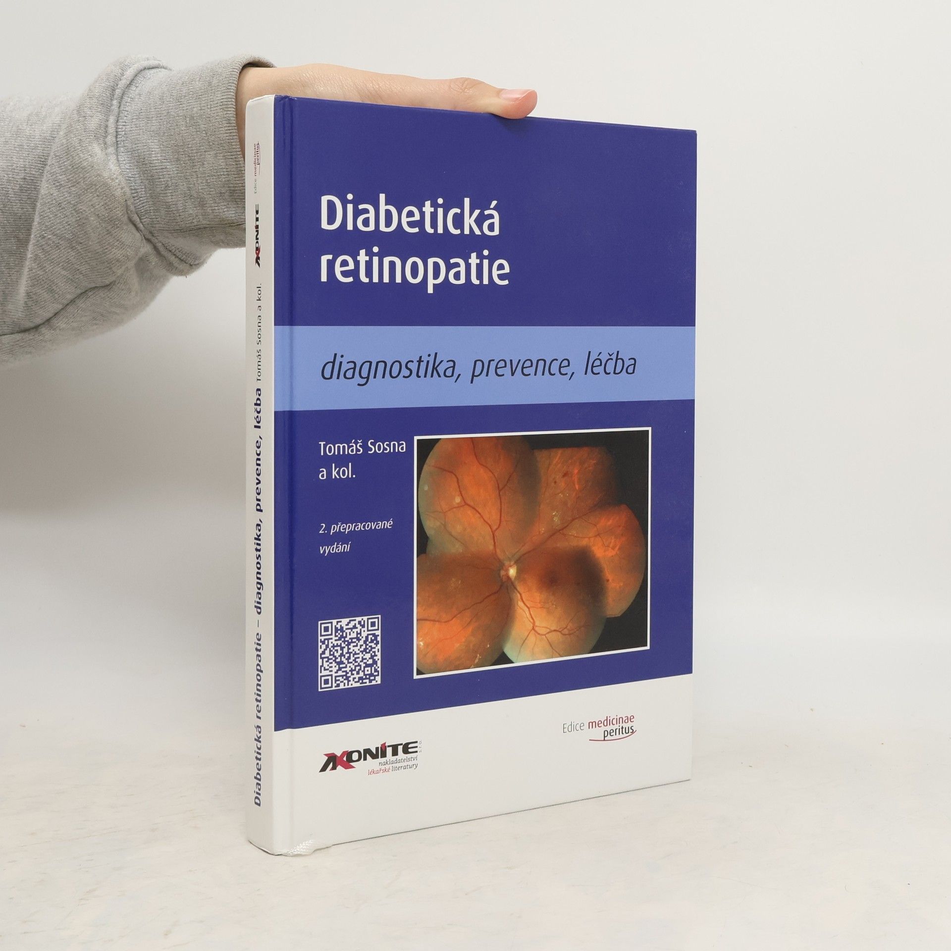 Tomáš Sosna Diabetická retinopatie