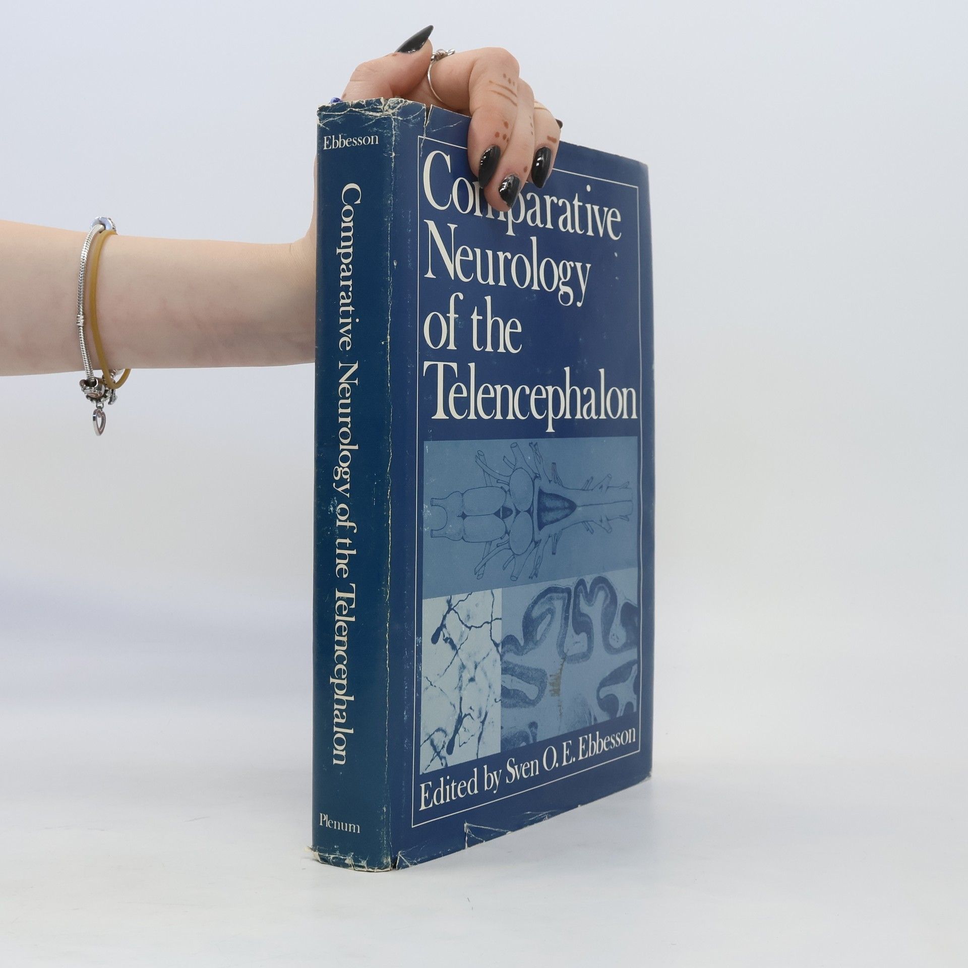 Sven O E Ebbesson Comparative Neurology of the Telencephalon