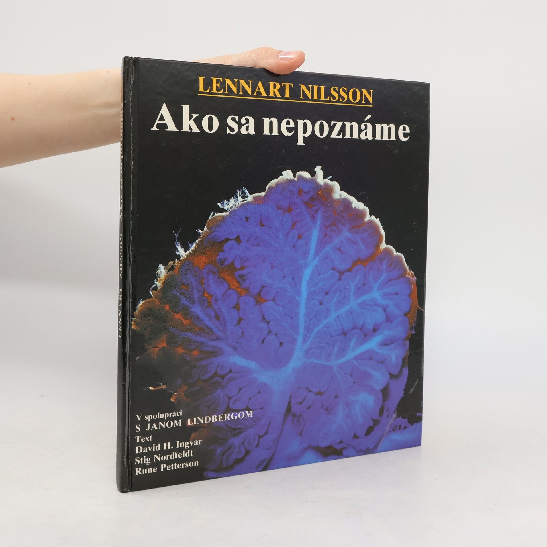 Autorenkollektiv Ako sa nepoznáme: Objavná cesta s fotografickým aparátom do nášho tela