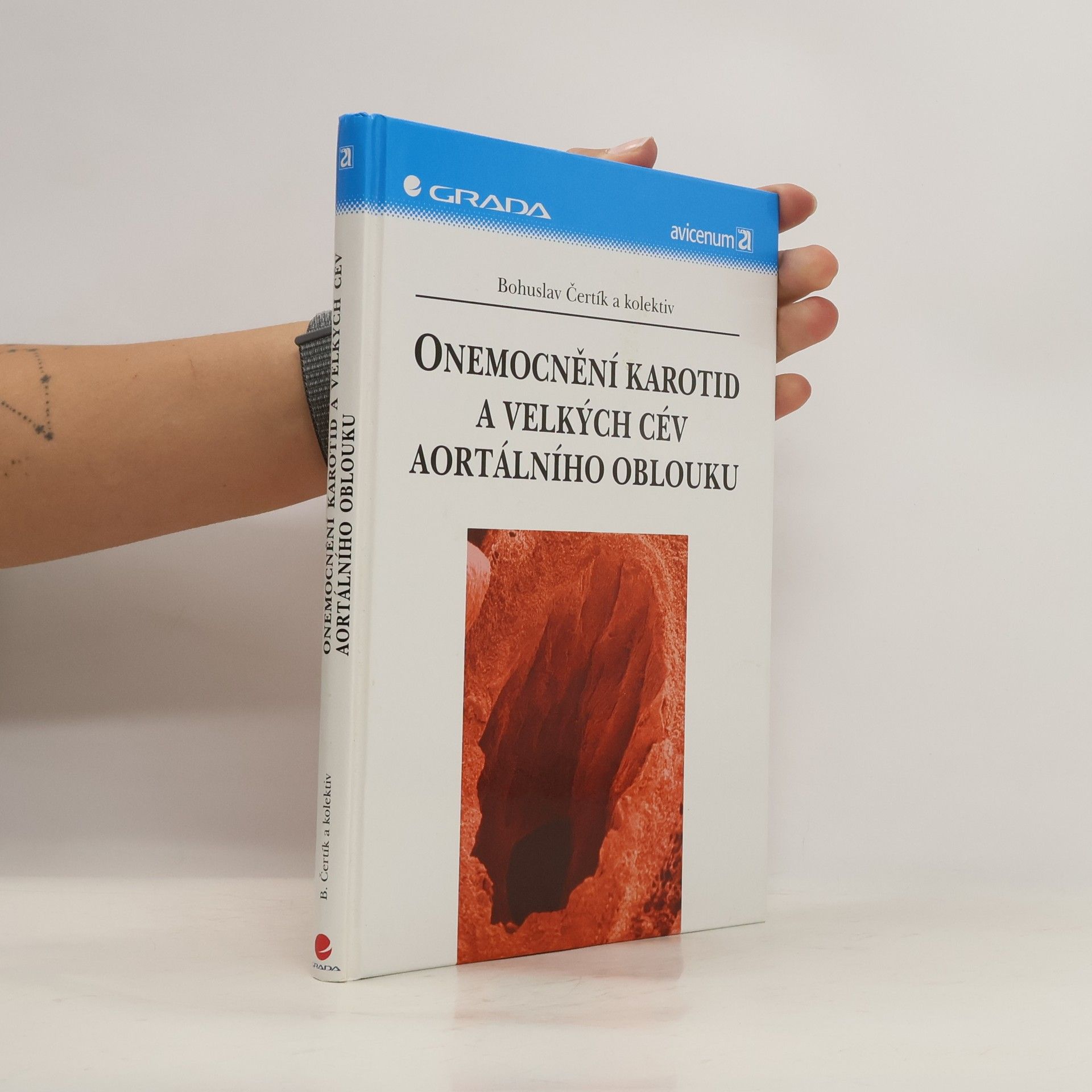 Bohuslav Čertík Onemocnění karotid a velkých cév aortálního oblouku