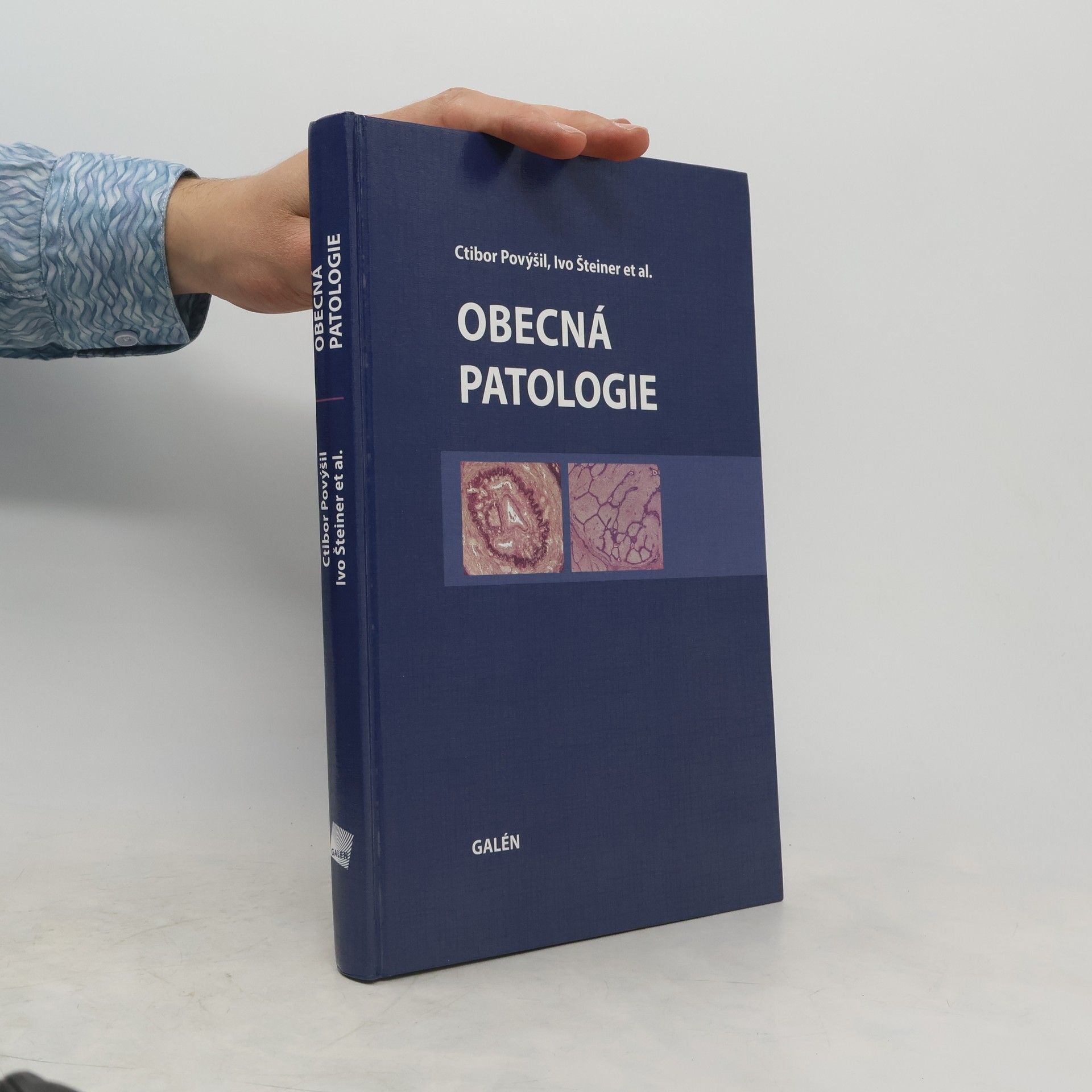 Ctibor Povýšil Obecná patologie