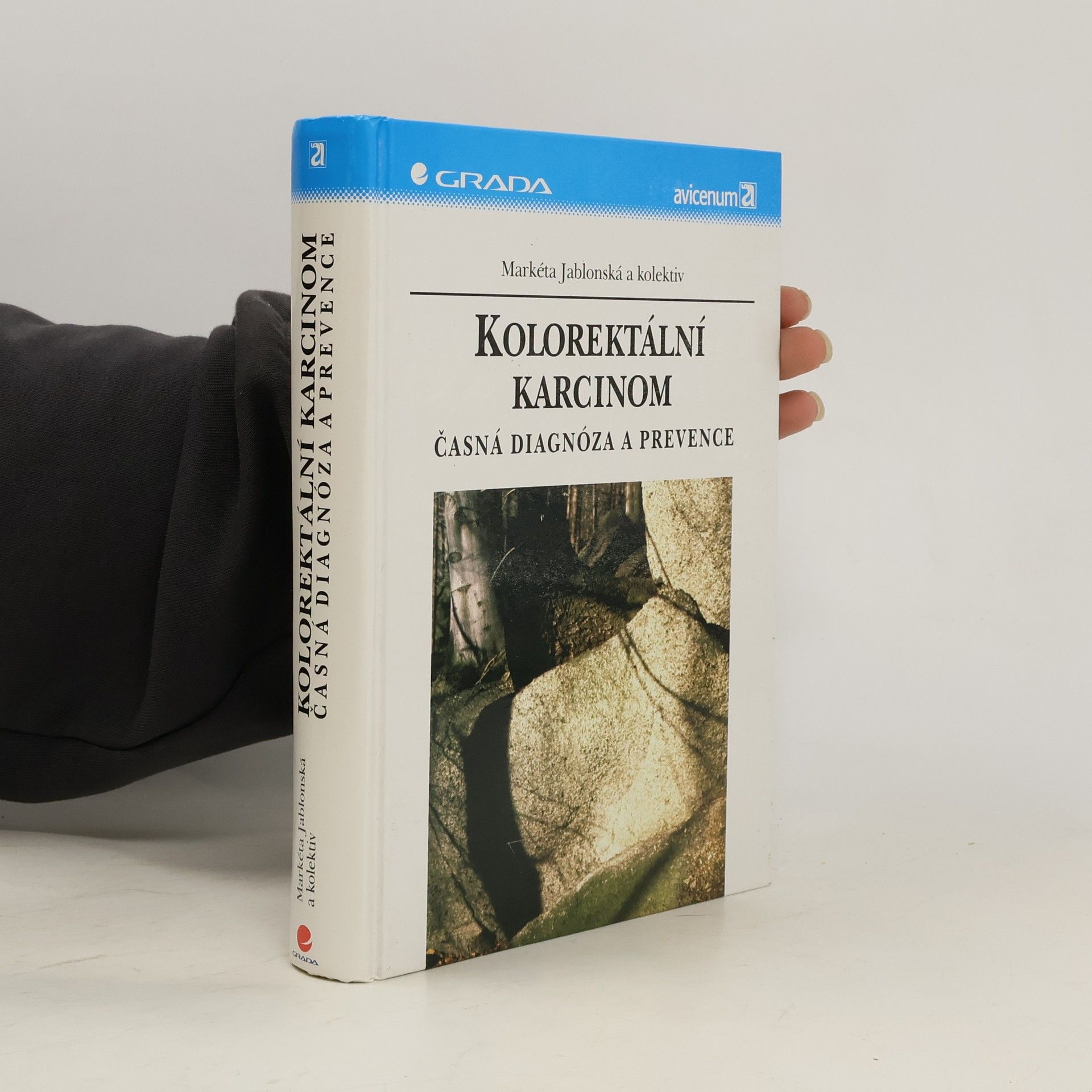 Markéta Jablonská Kolorektální karcinom : časná diagnóza a prevence