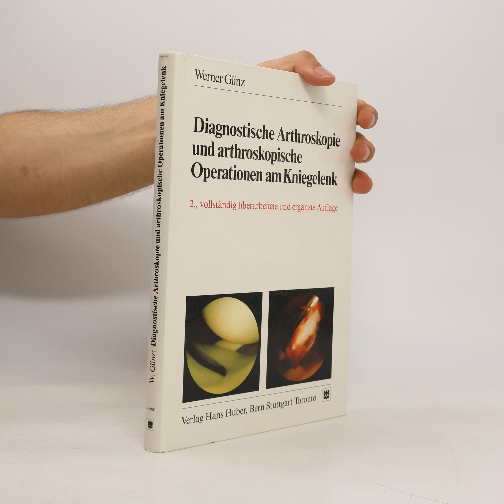 Werner Glinz Diagnostische Arthroskopie und arthroskopische Operationen am Kniegelenk