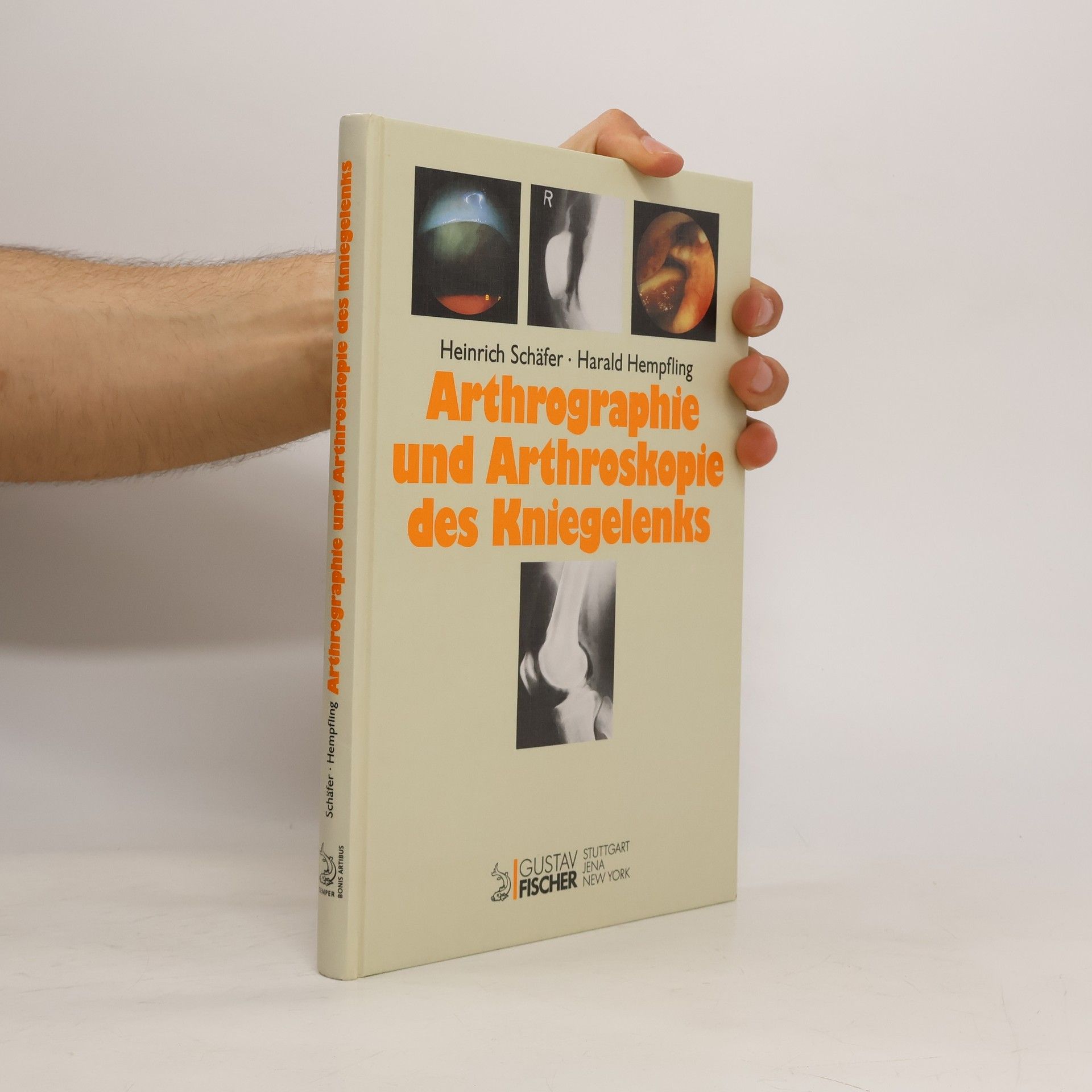 Heinrich Schäfer Arthrographie und Arthroskopie des Kniegelenks