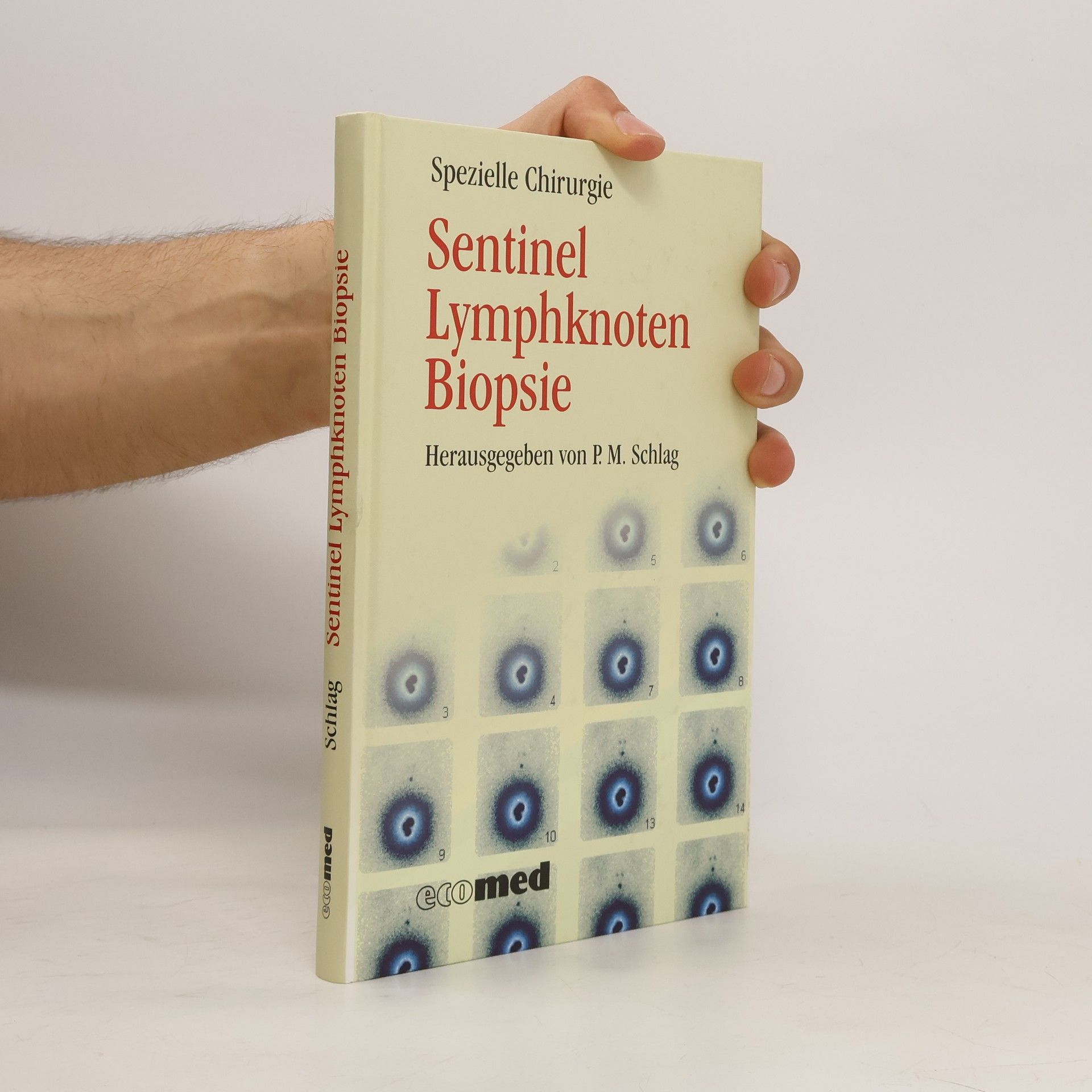 Peter M. Schlag Sentinel-Lymphknoten-Biopsie