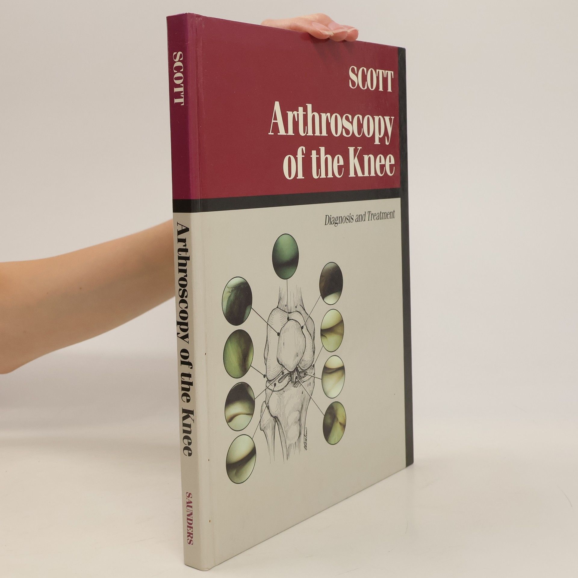 W. Norman Scott Arthroscopy of the Knee