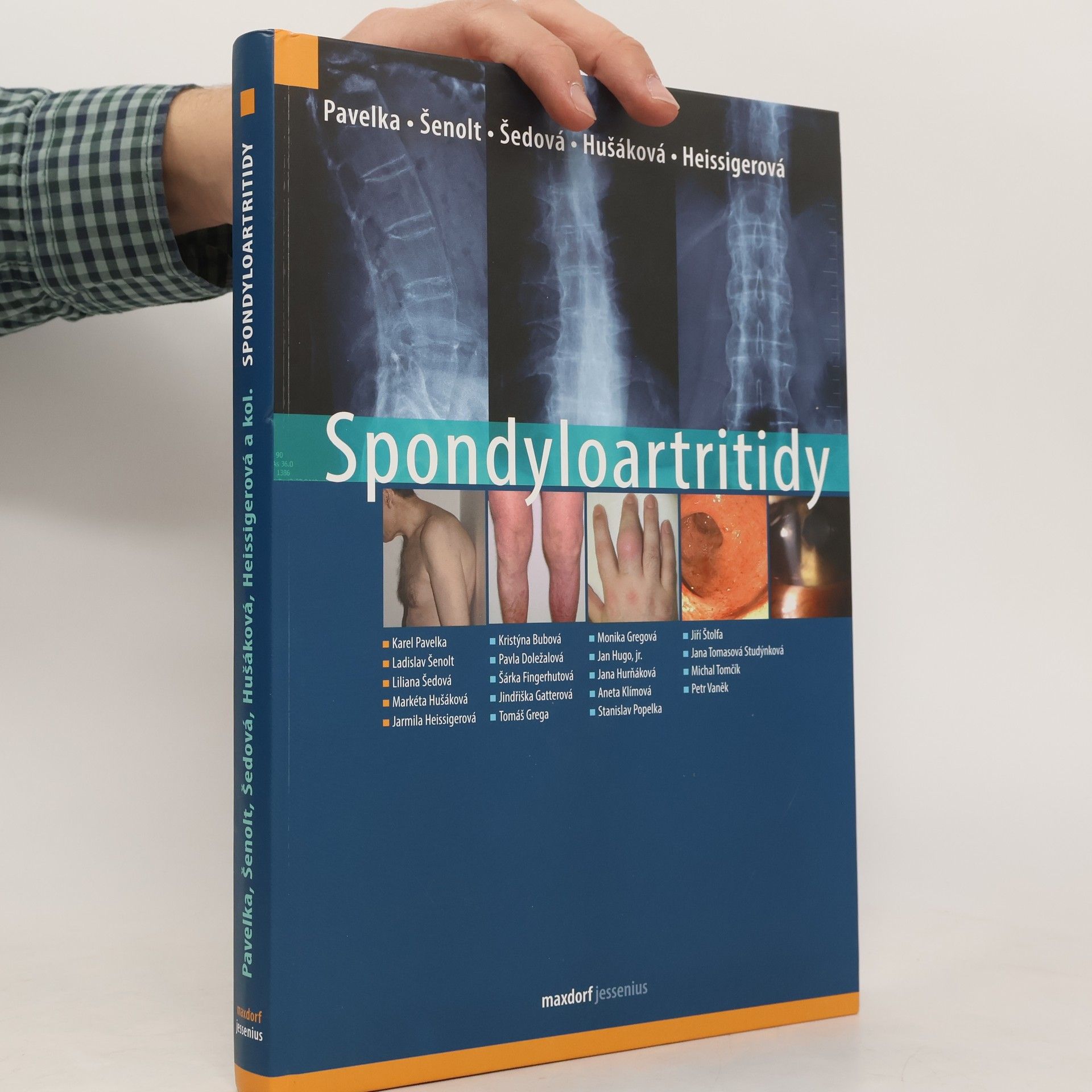 Karel Pavelka Spondyloartritidy