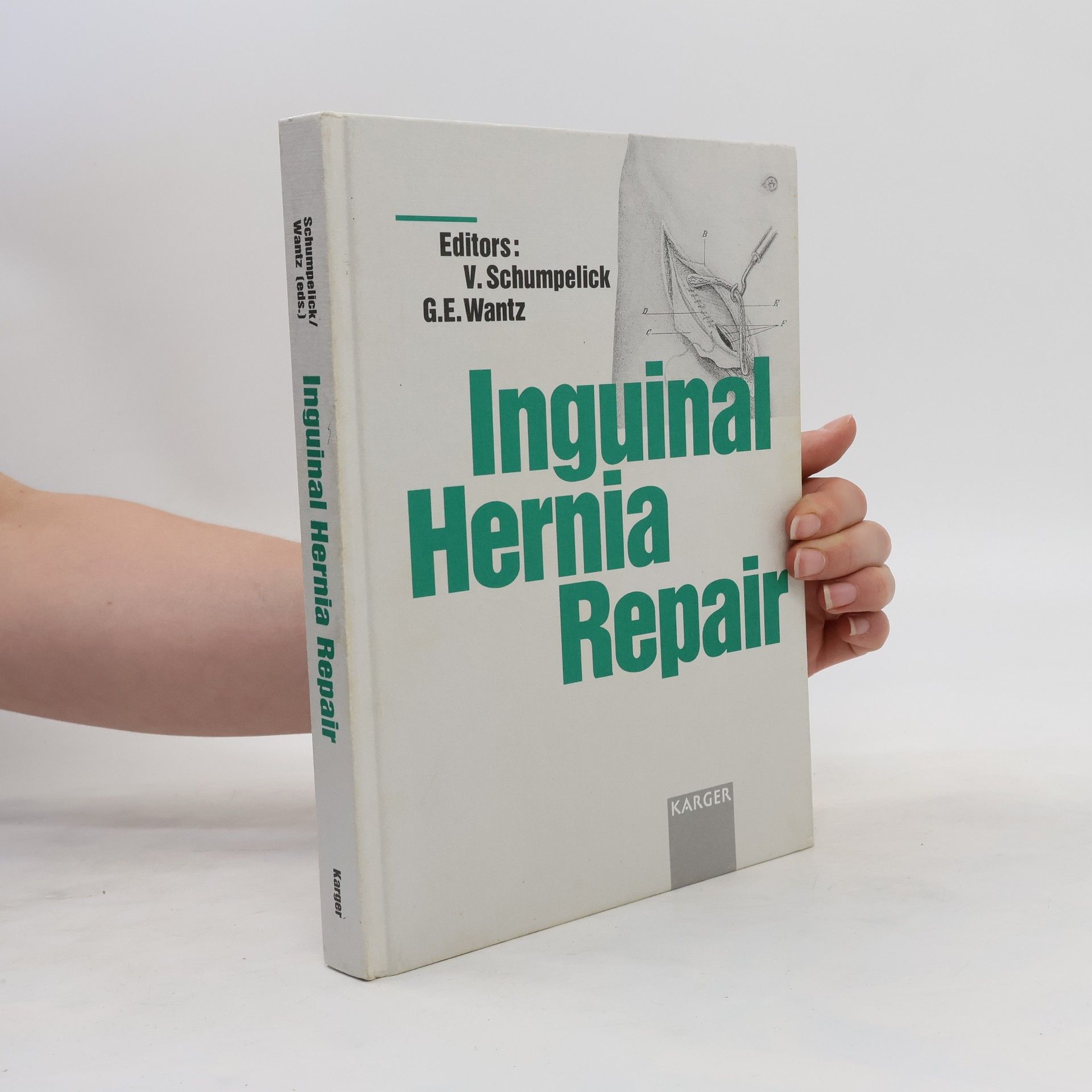 Volker Schumpelick Inguinal hernia repair
