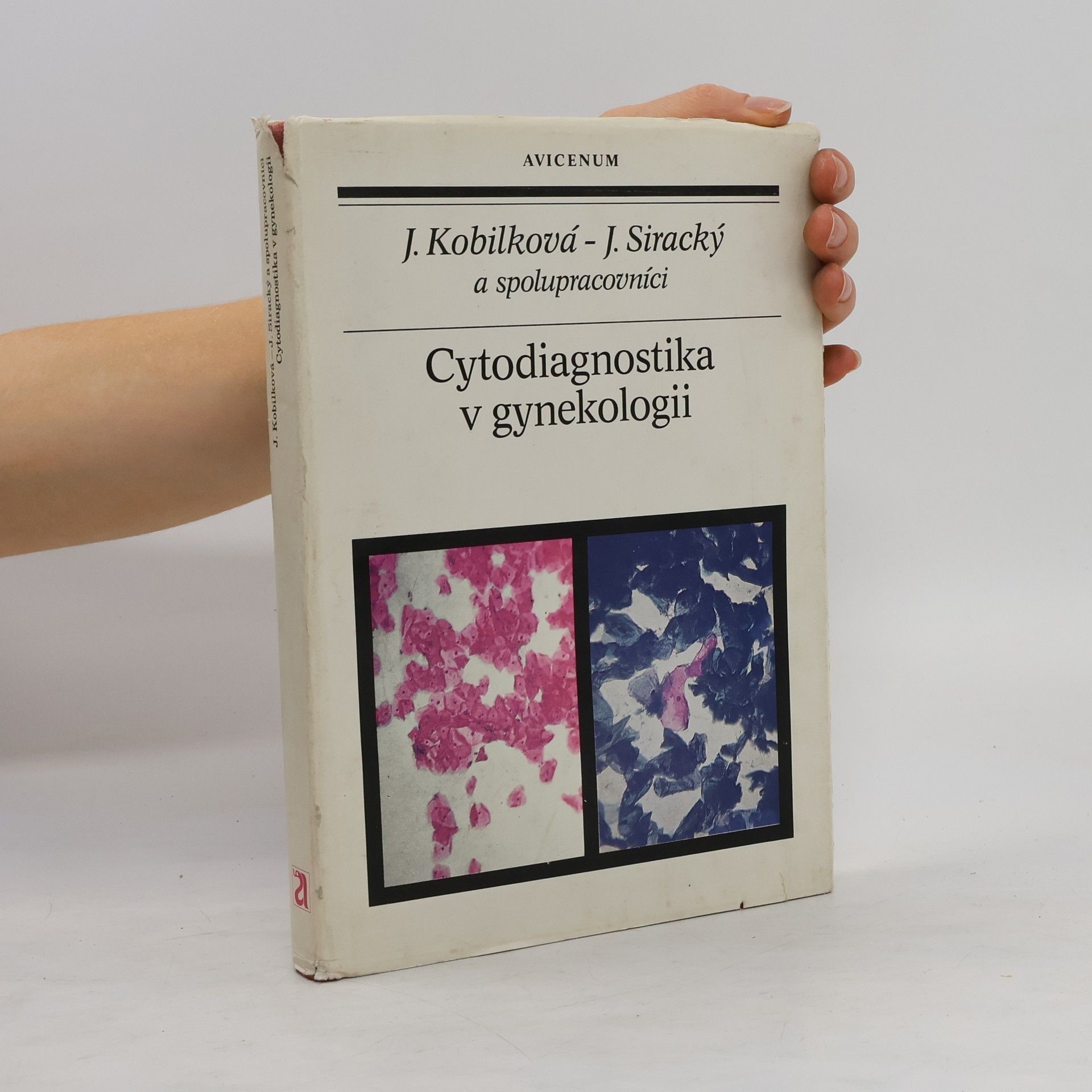Jitka Kobilková Cytodiagnostika v gynekologii