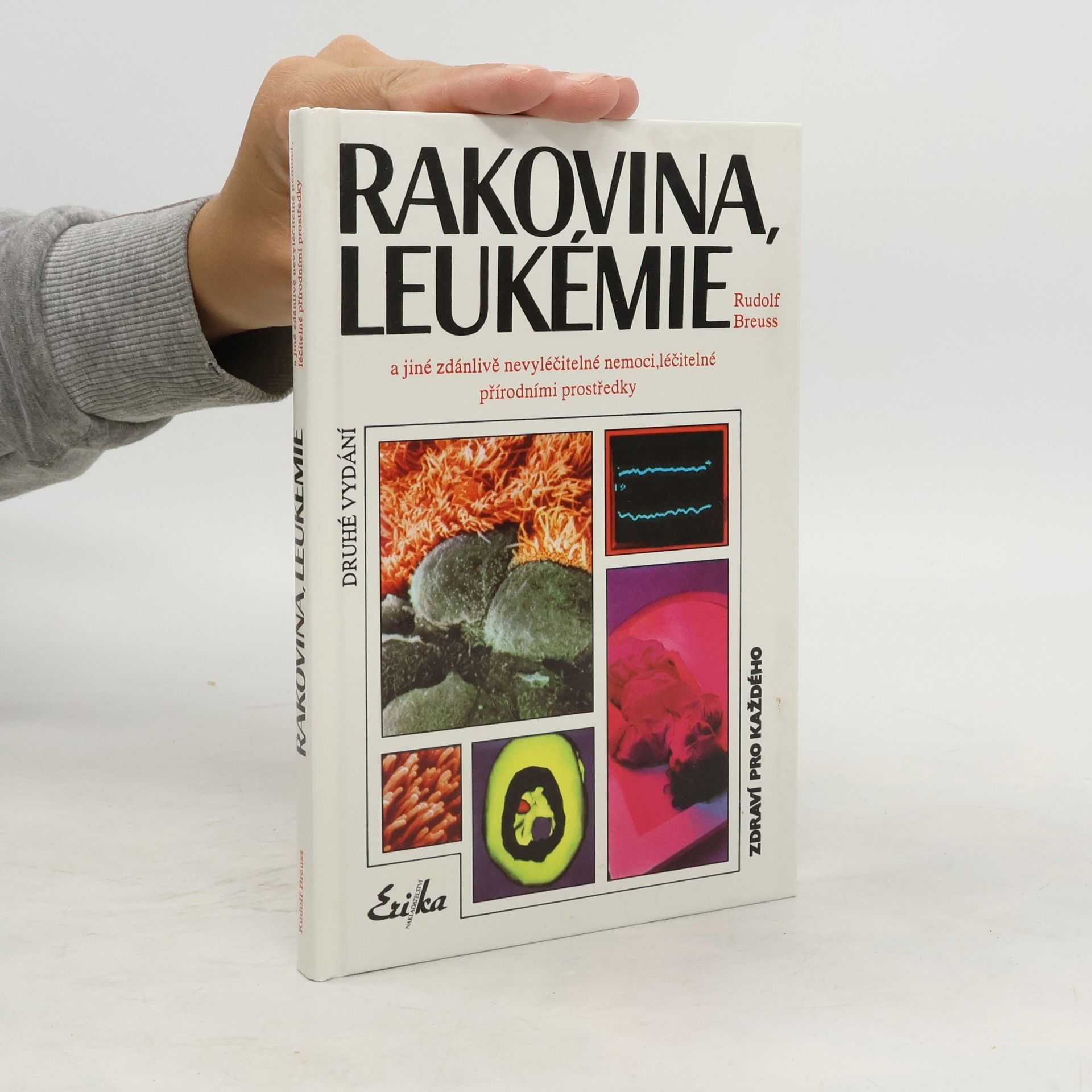 Rudolf Breuss Rakovina, leukémie a jiné zdánlivě nevyléčitelné nemoci, které jsou léčitelné přírodními prostředky: Záznamy z tisíců zkušeností k blahu všeho lidstva na přání mnoha vyléčených pacientů a také na přání dobrých lékařů
