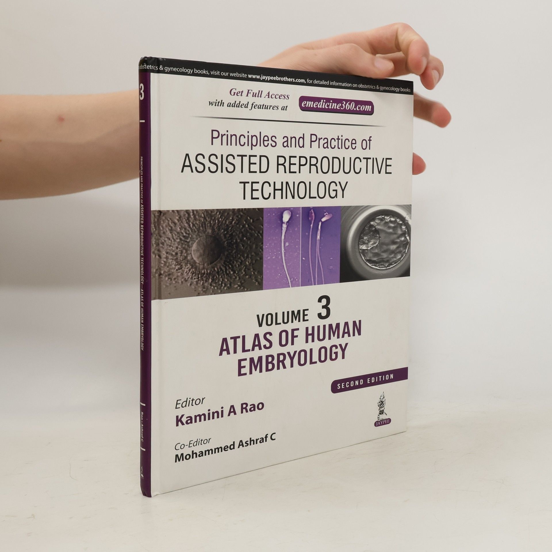 Kamini A Rao Principles and Practice of Assisted Reproductive Technology Volume 3