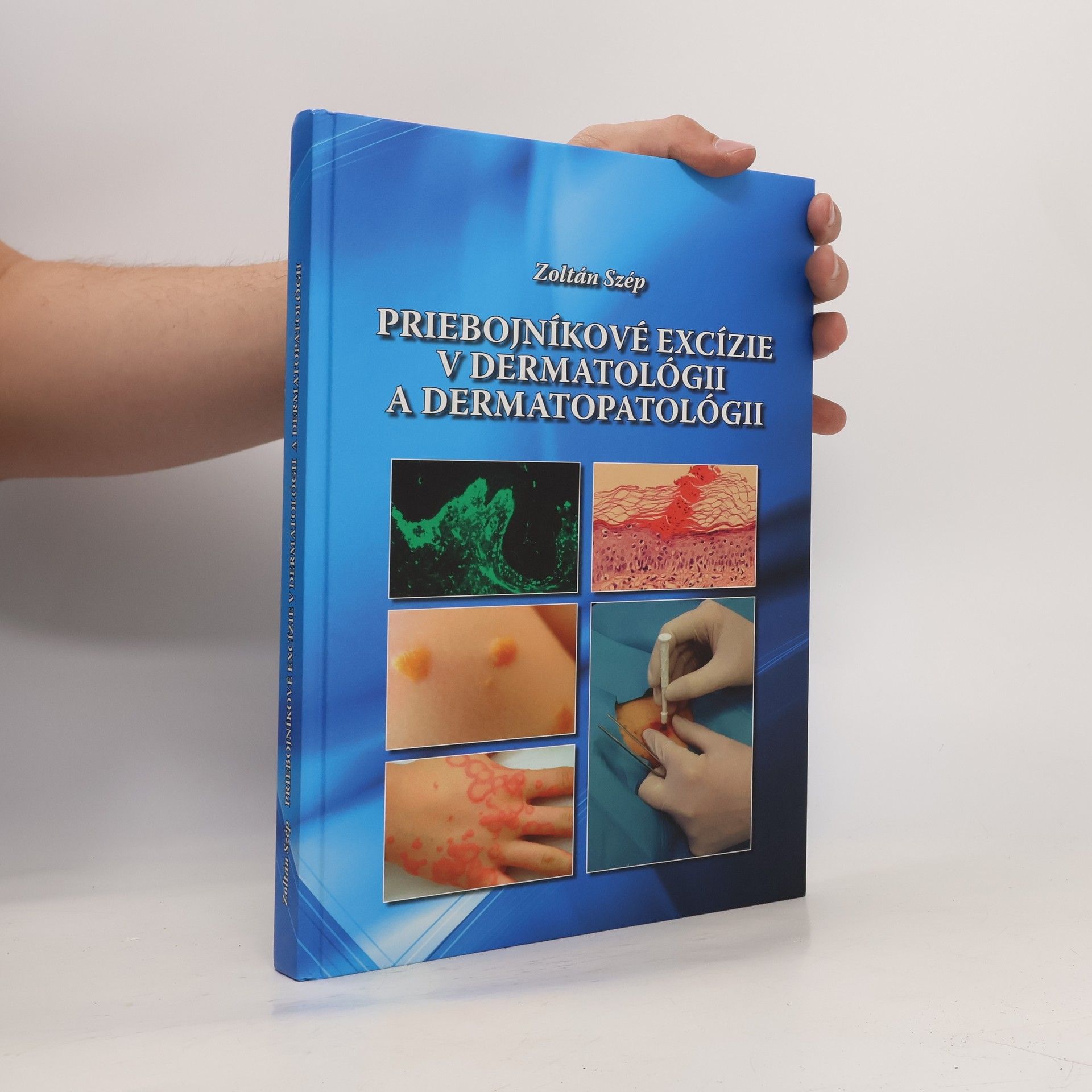Zoltán Szép Priebojníkové excízie v dermatológii a dermatopatológii
