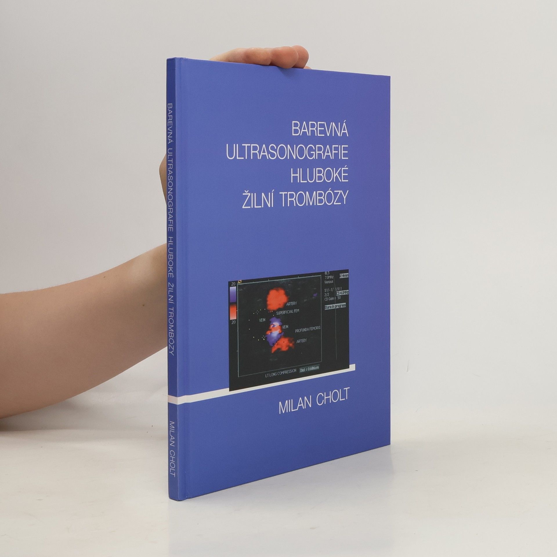 Milan Cholt Barevná ultrasonografie hluboké žilní trombózy