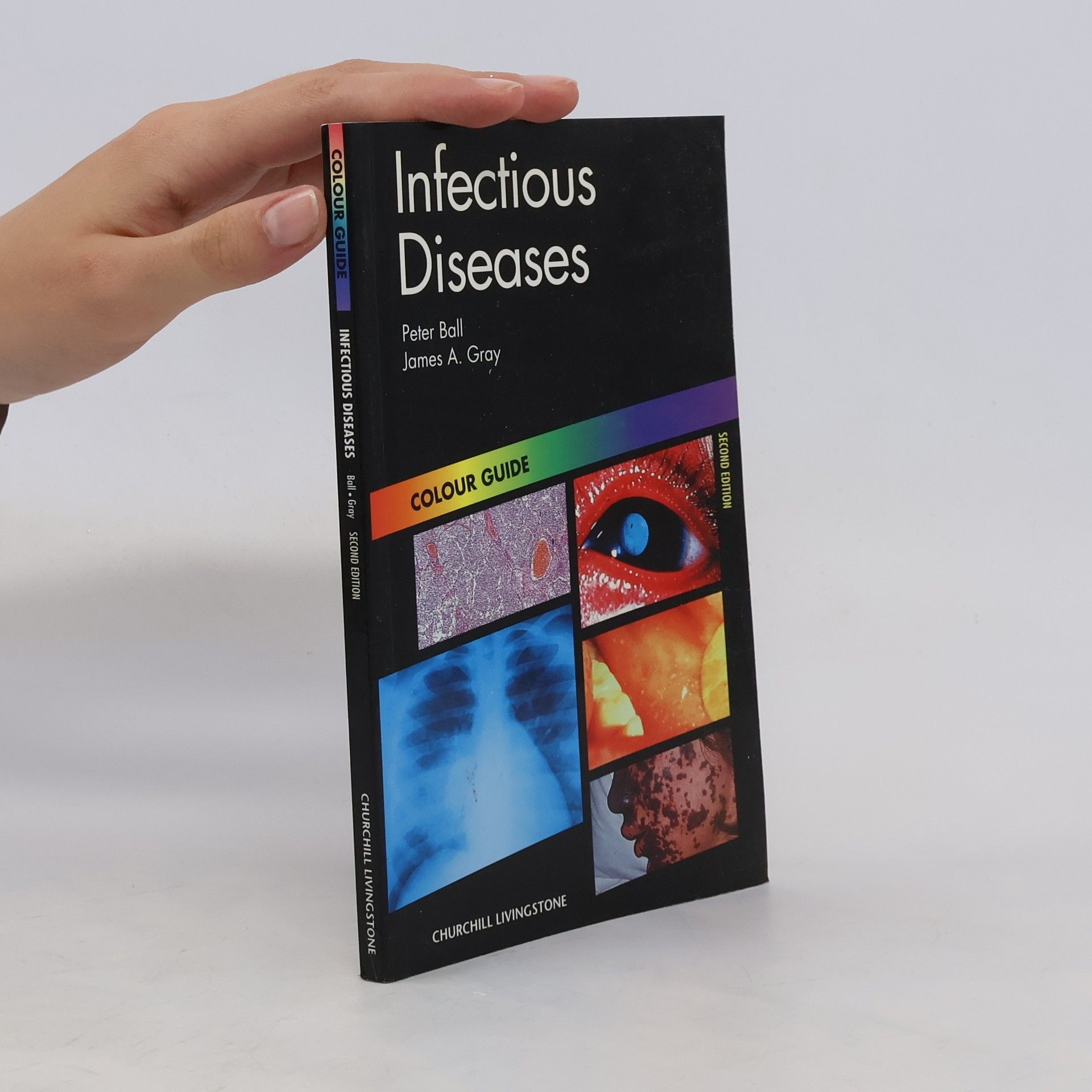 Peter M. Ball Infectious diseases