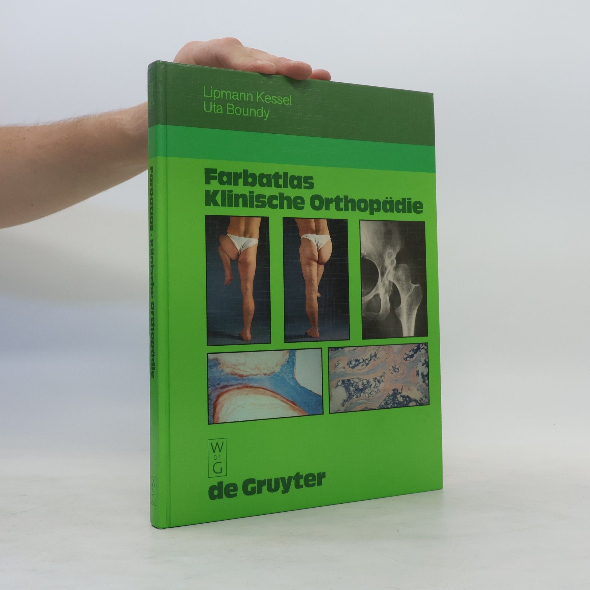 Lipmann Kessel Farbatlas klinische Orthopädie