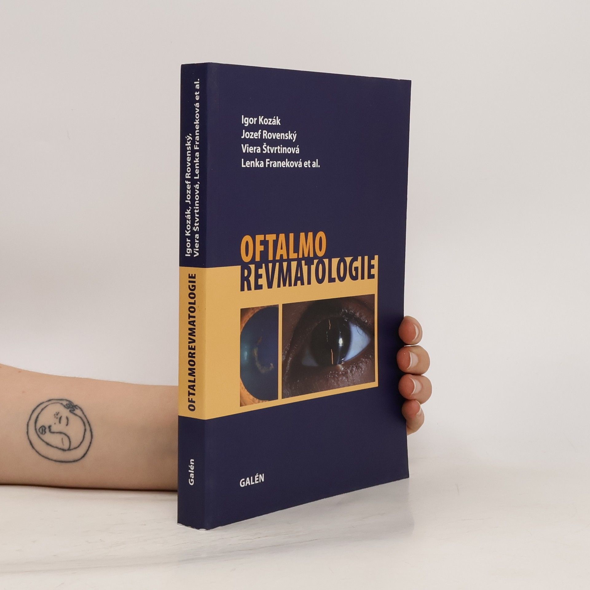 Lenka Franeková Oftalmorevmatologie