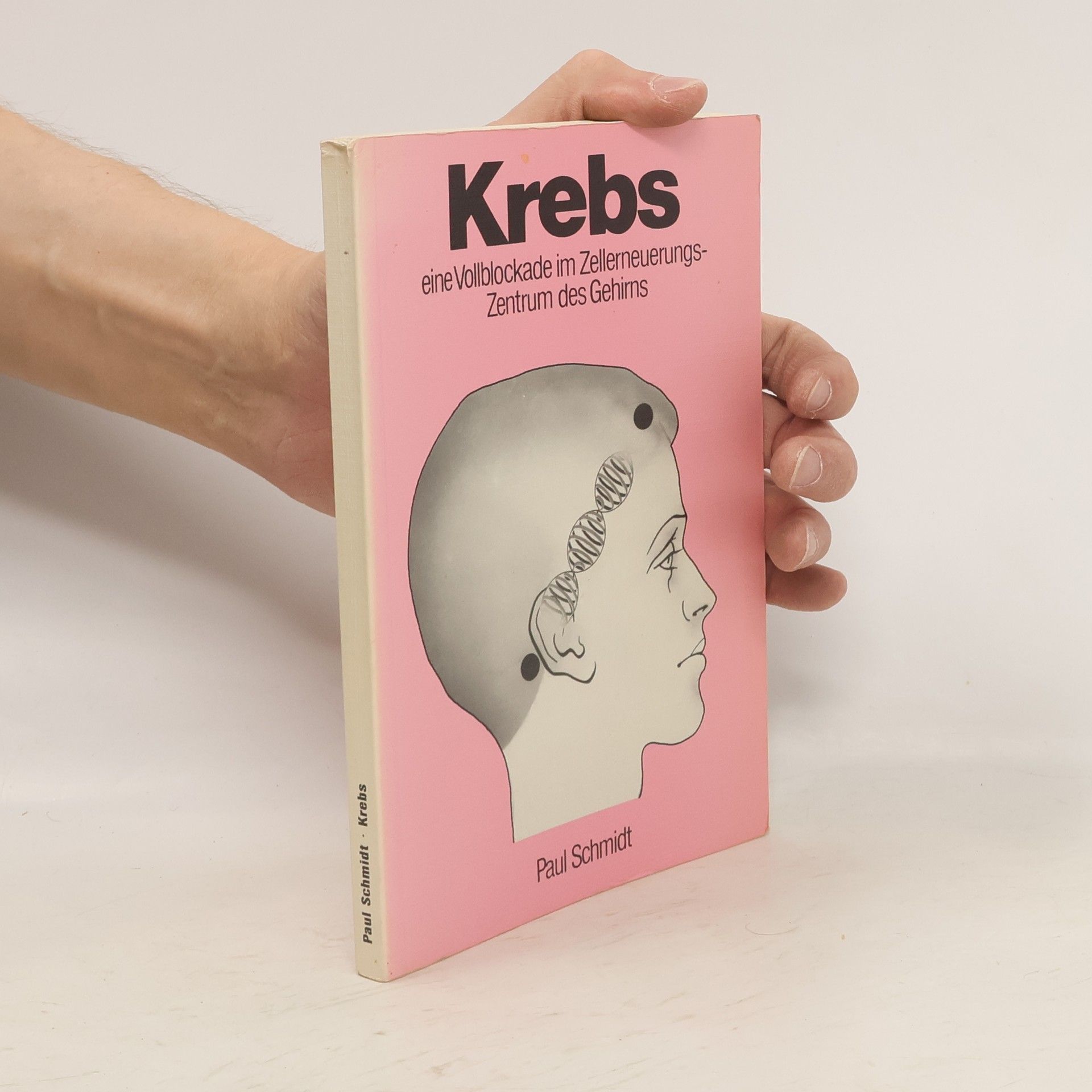 Paul-Otto Schmidt Krebs. Eine Vollblockade im Zellerneuerungszentrum des Gehirns