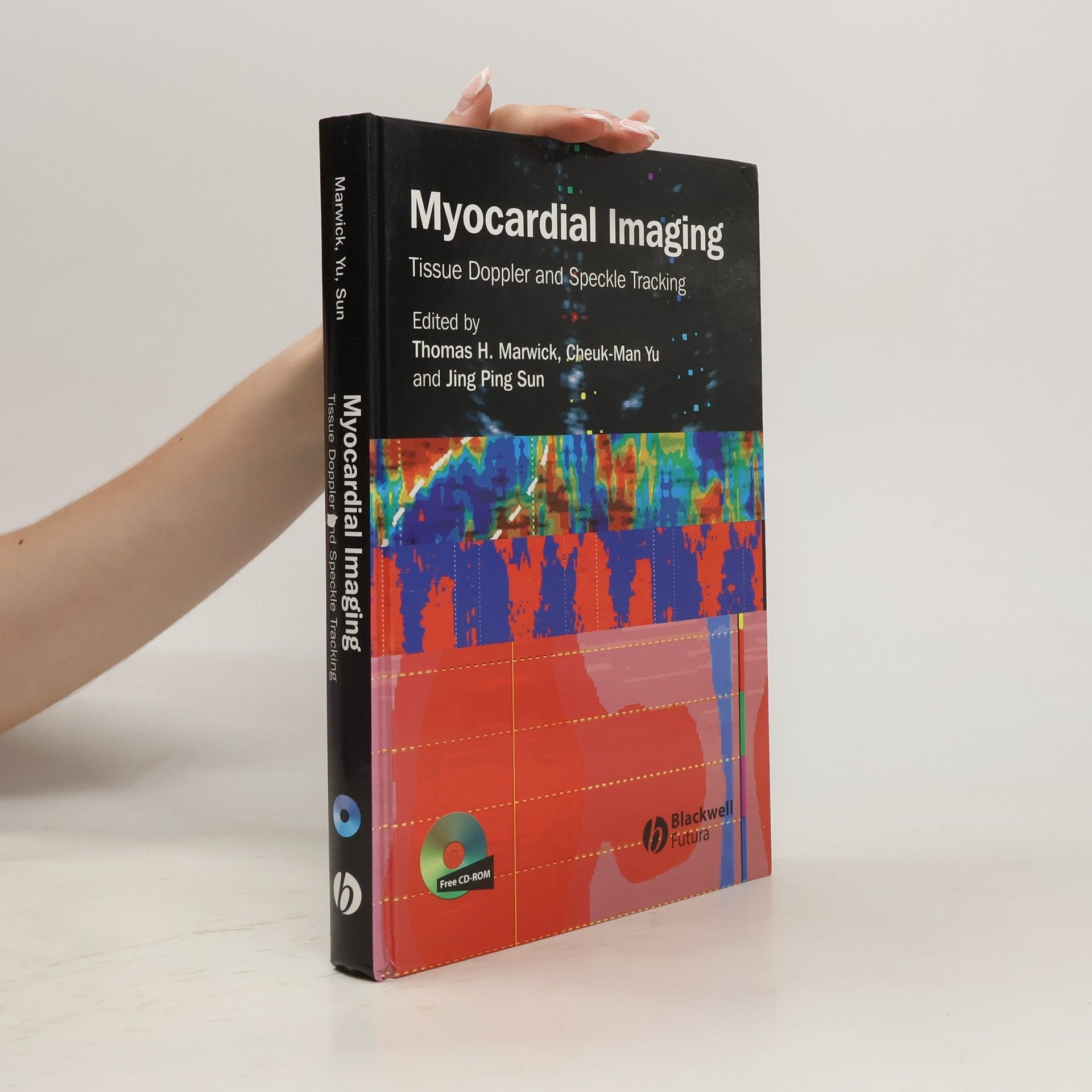 Thomas H. Marwick Myocardial Imaging