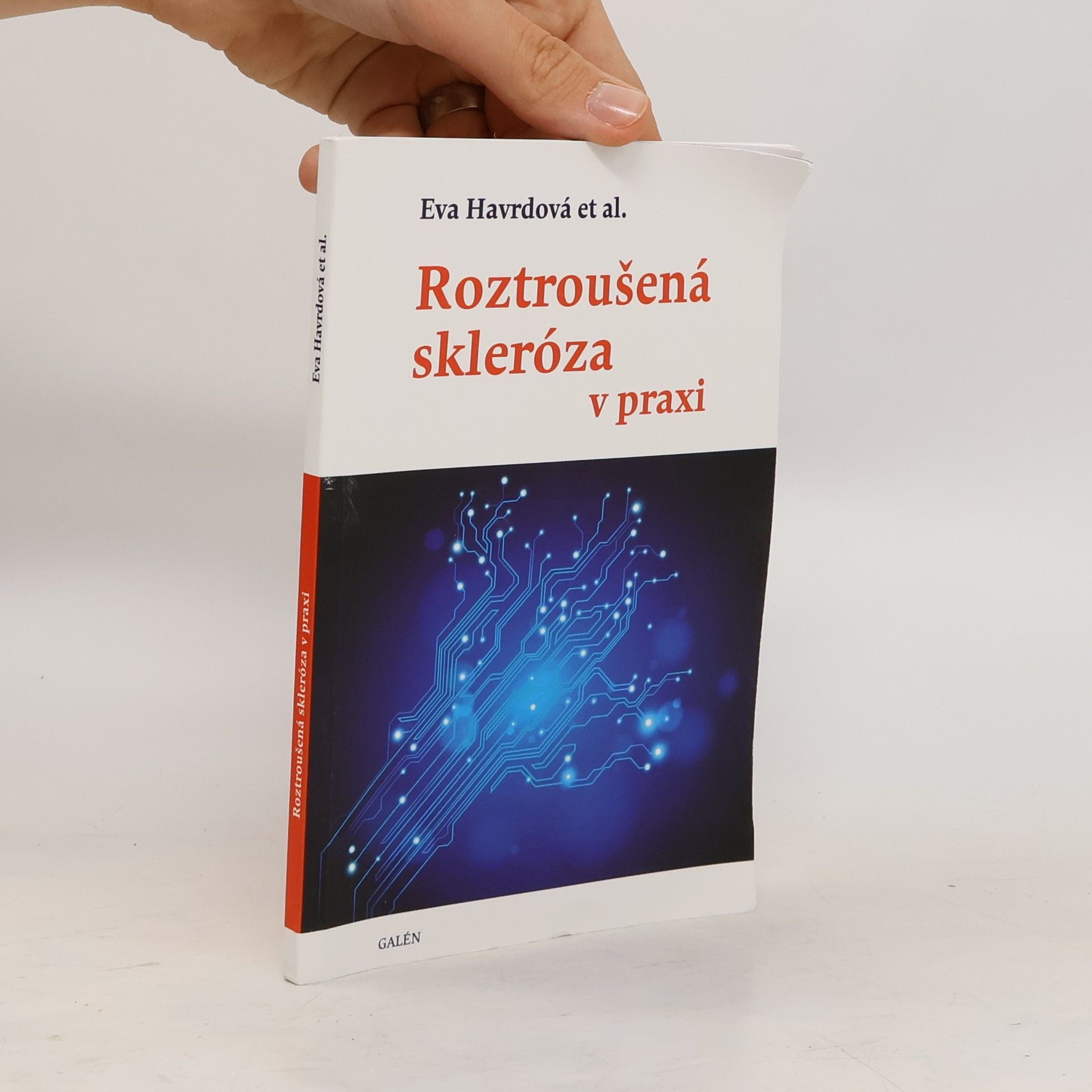 Eva Havrdová Roztroušená skleróza v praxi