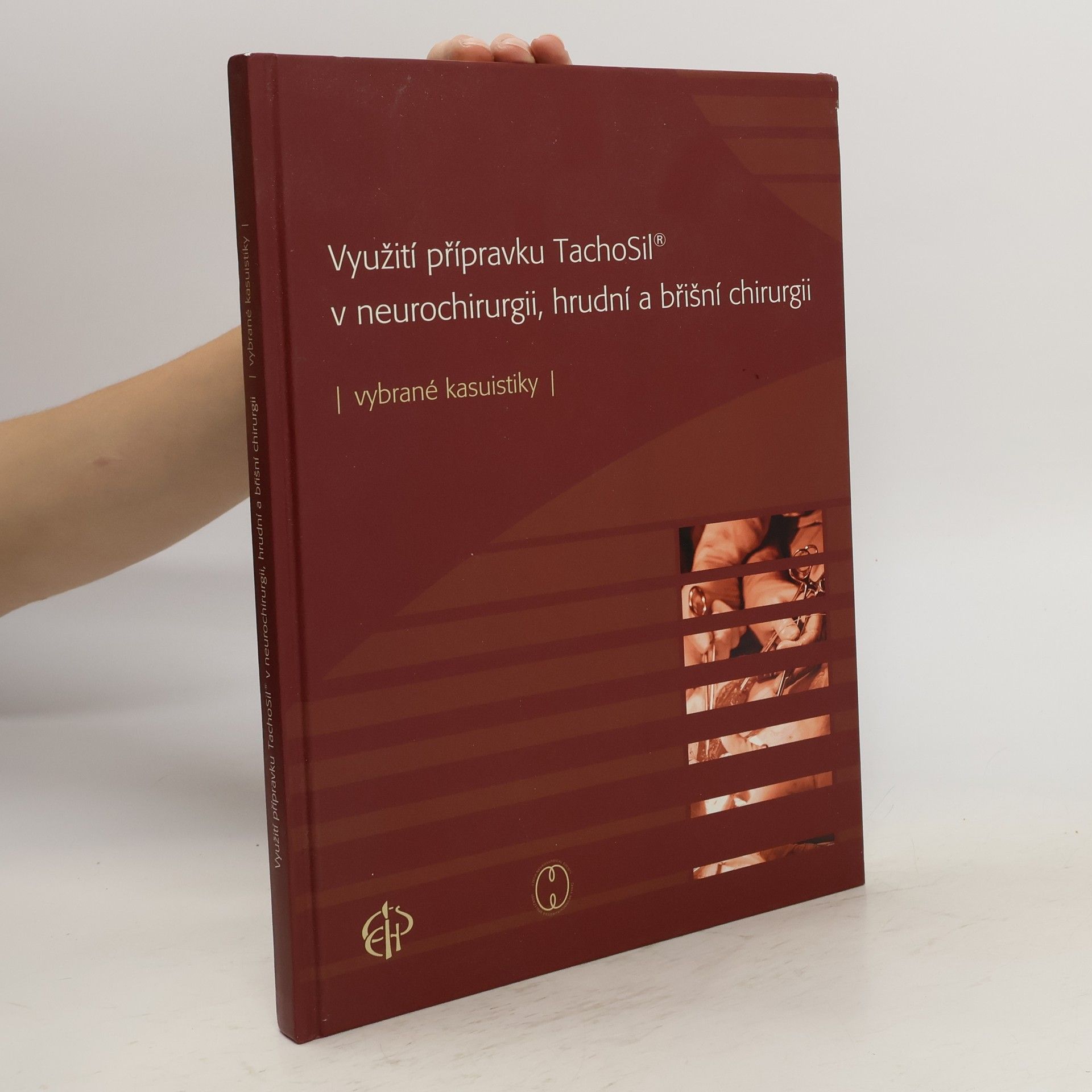 Autorenkollektiv Využití přípravku TachoSil v neurochirurgii, hrudní a břišní chirurgii : vybrané kasuistiky