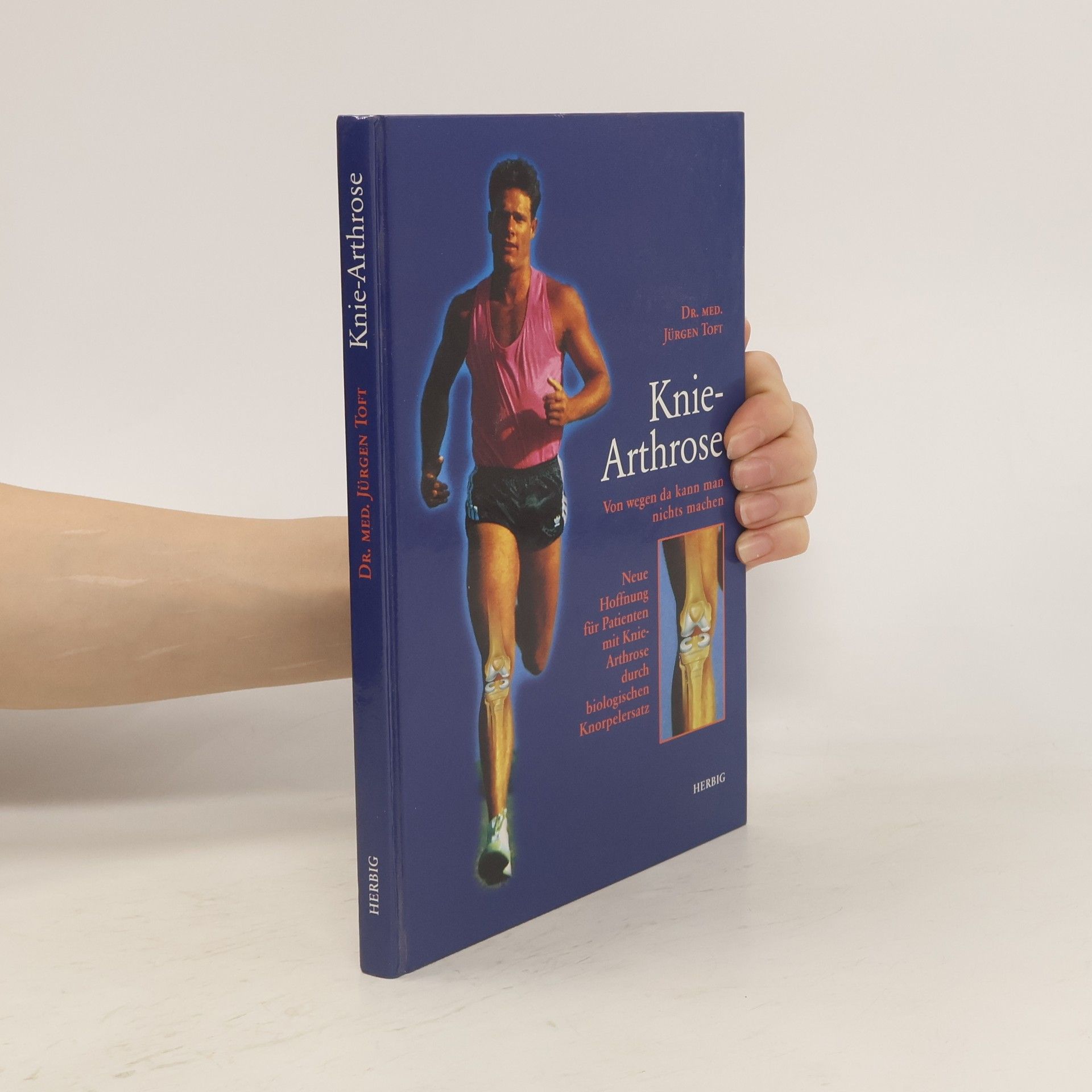 Jürgen Toft Knie-Arthrose