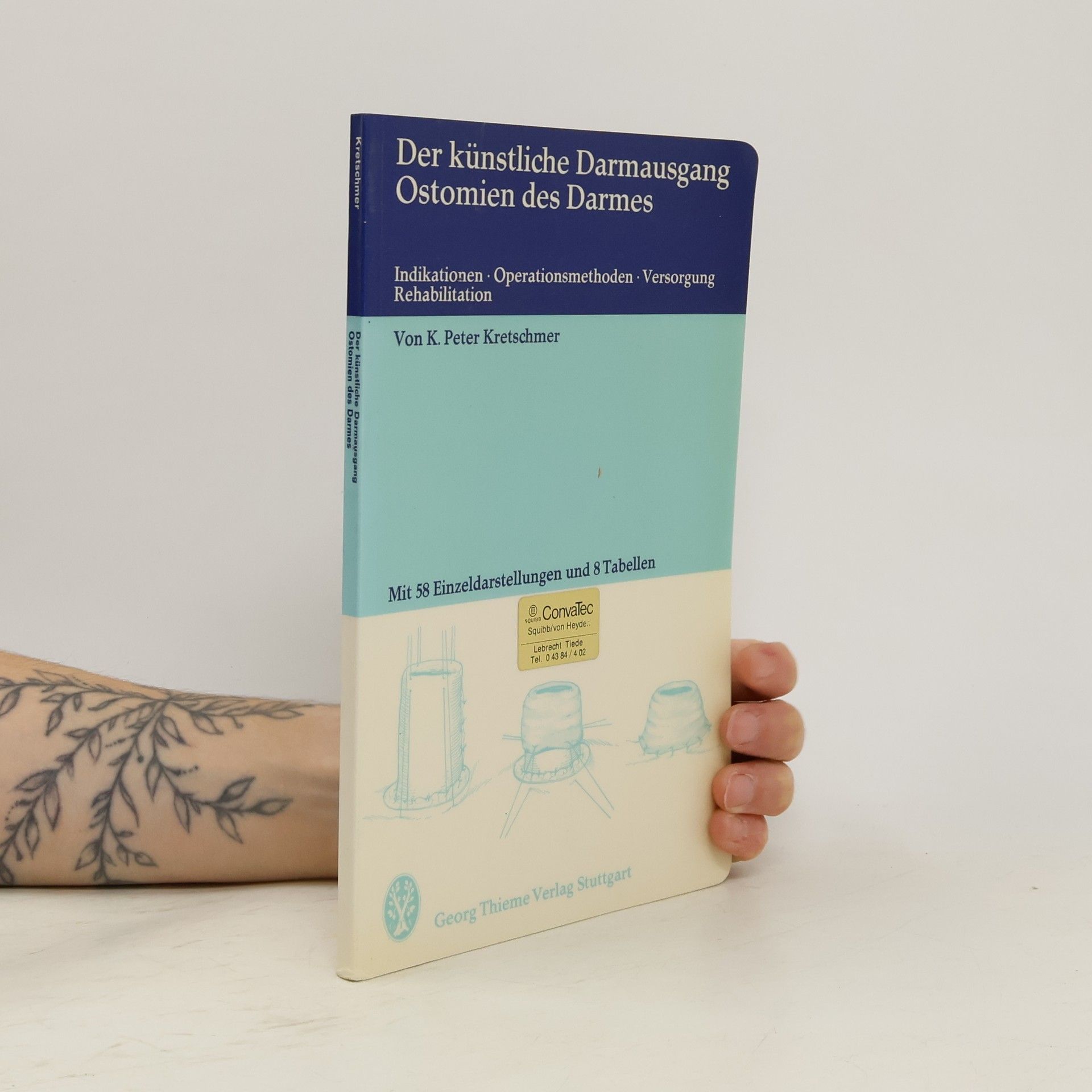 Peter Kretschmer Der künstliche Darmausgang, Ostomien des Darmes