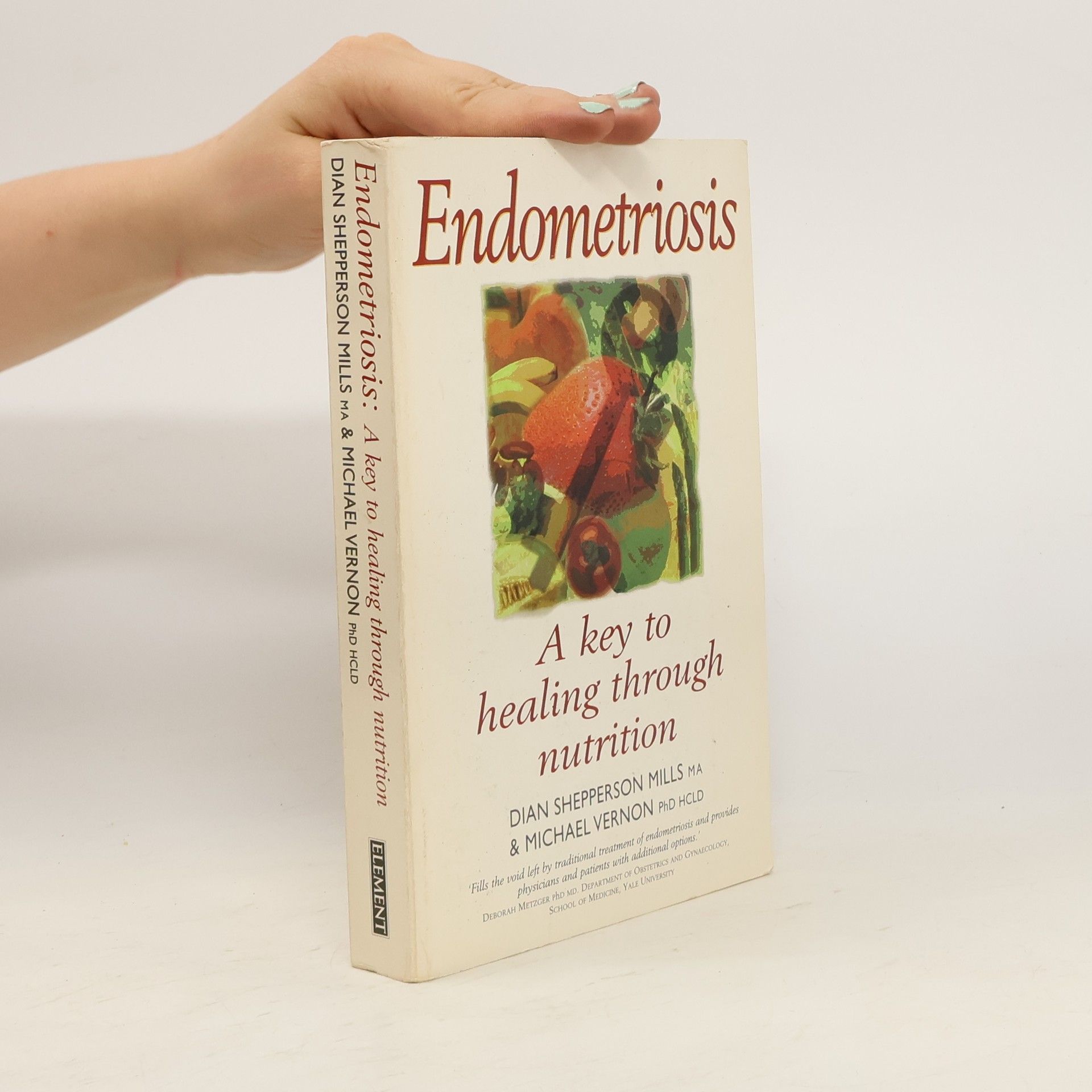 Dian Shepperson Mills Endometriosis