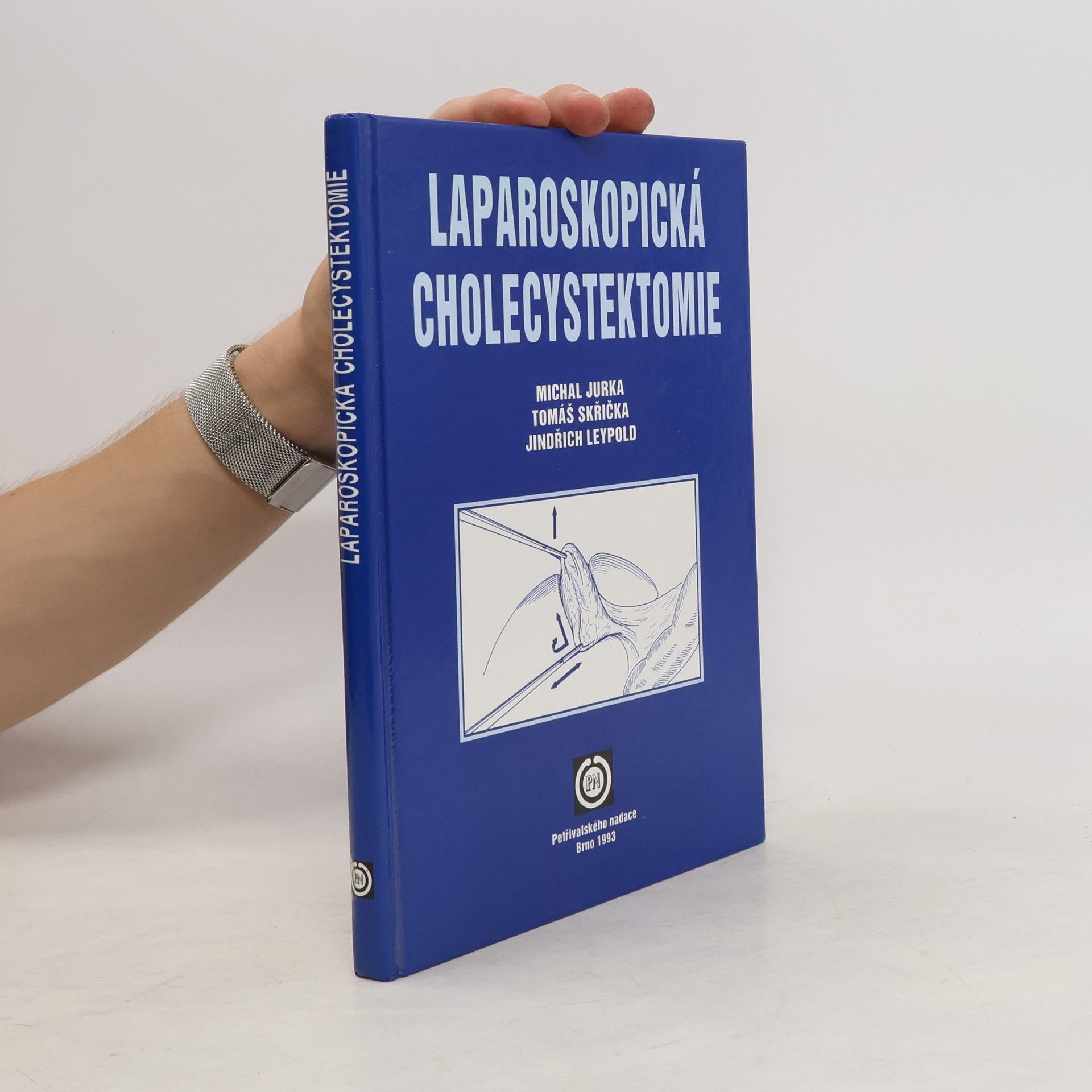 Michal Jurka Laparoskopická cholecystektomie