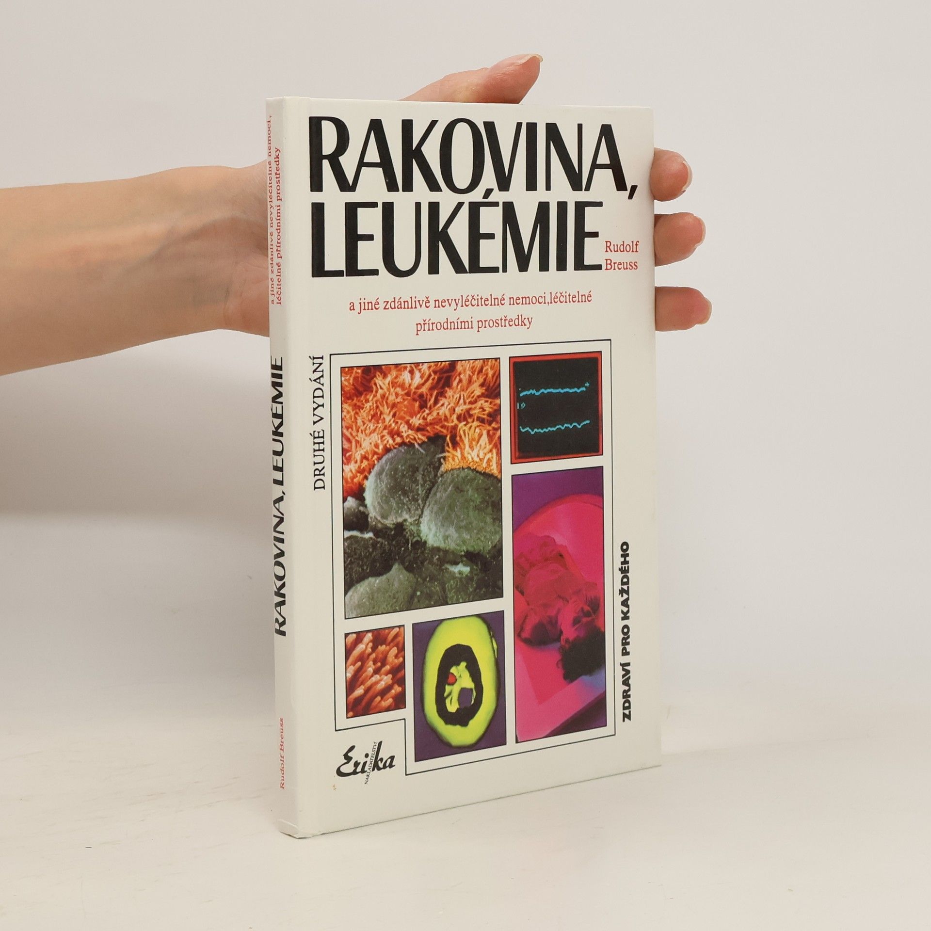 Rudolf Breuss Rakovina, leukémie a jiné zdánlivě nevyléčitelné nemoci, které jsou léčitelné přírodními prostředky: Záznamy z tisíců zkušeností k blahu všeho lidstva na přání mnoha vyléčených pacientů a také na přání dobrých lékařů