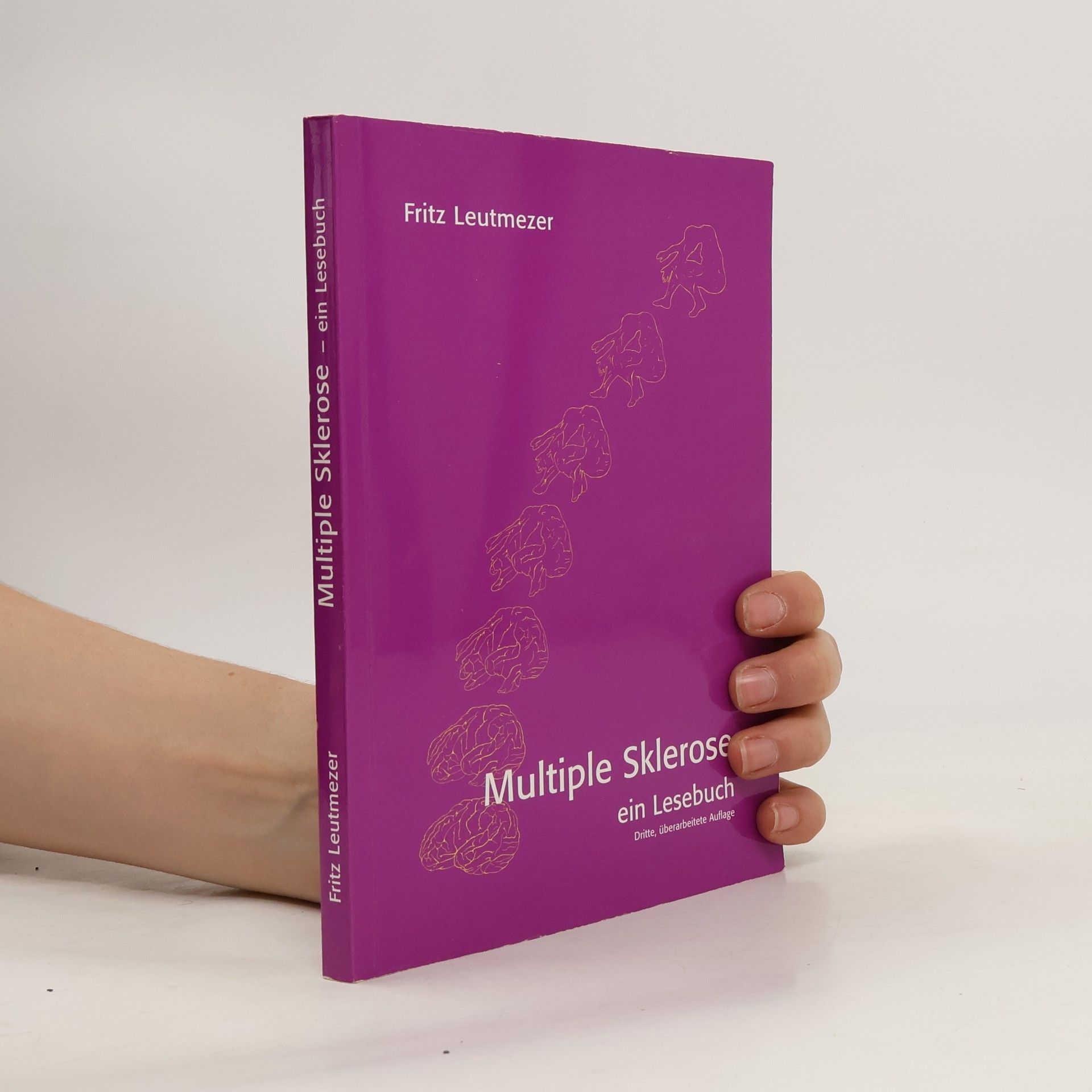 Fritz Leutmezer Multiple Sklerose ein Lesebuch
