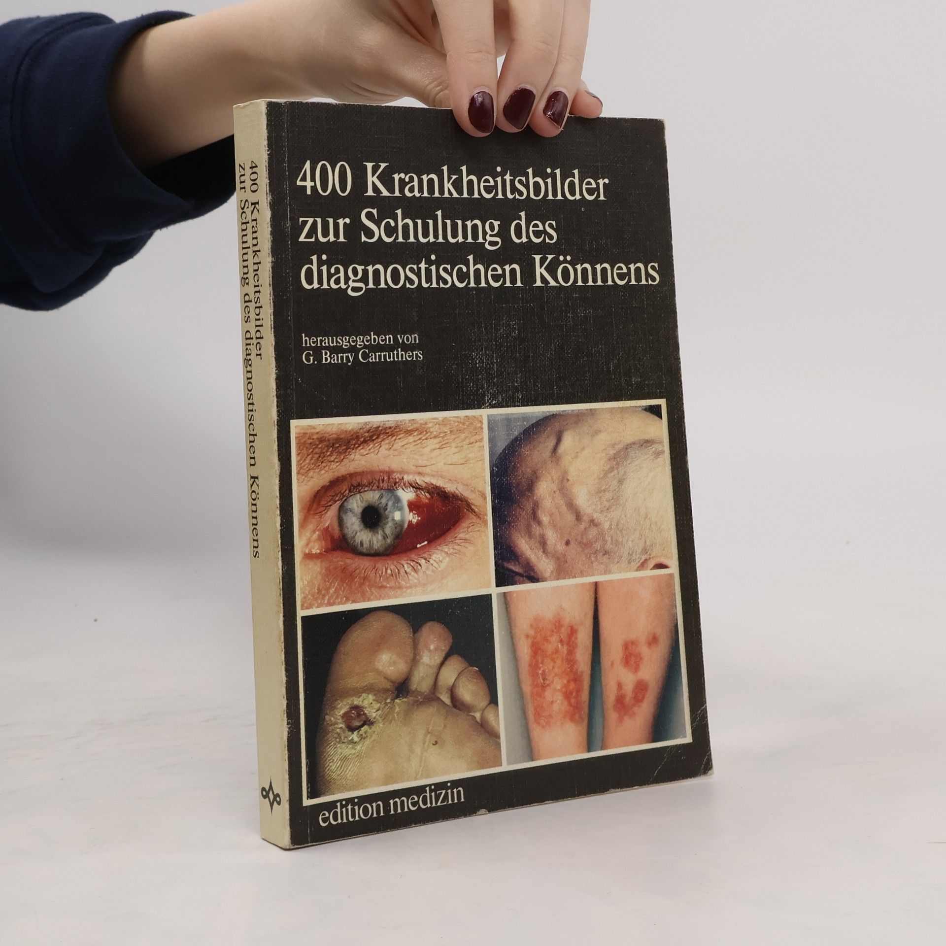 G. Barry Carruthers 400 [Vierhundert] Krankheitsbilder zur Schulung des diagnostischen Könnens