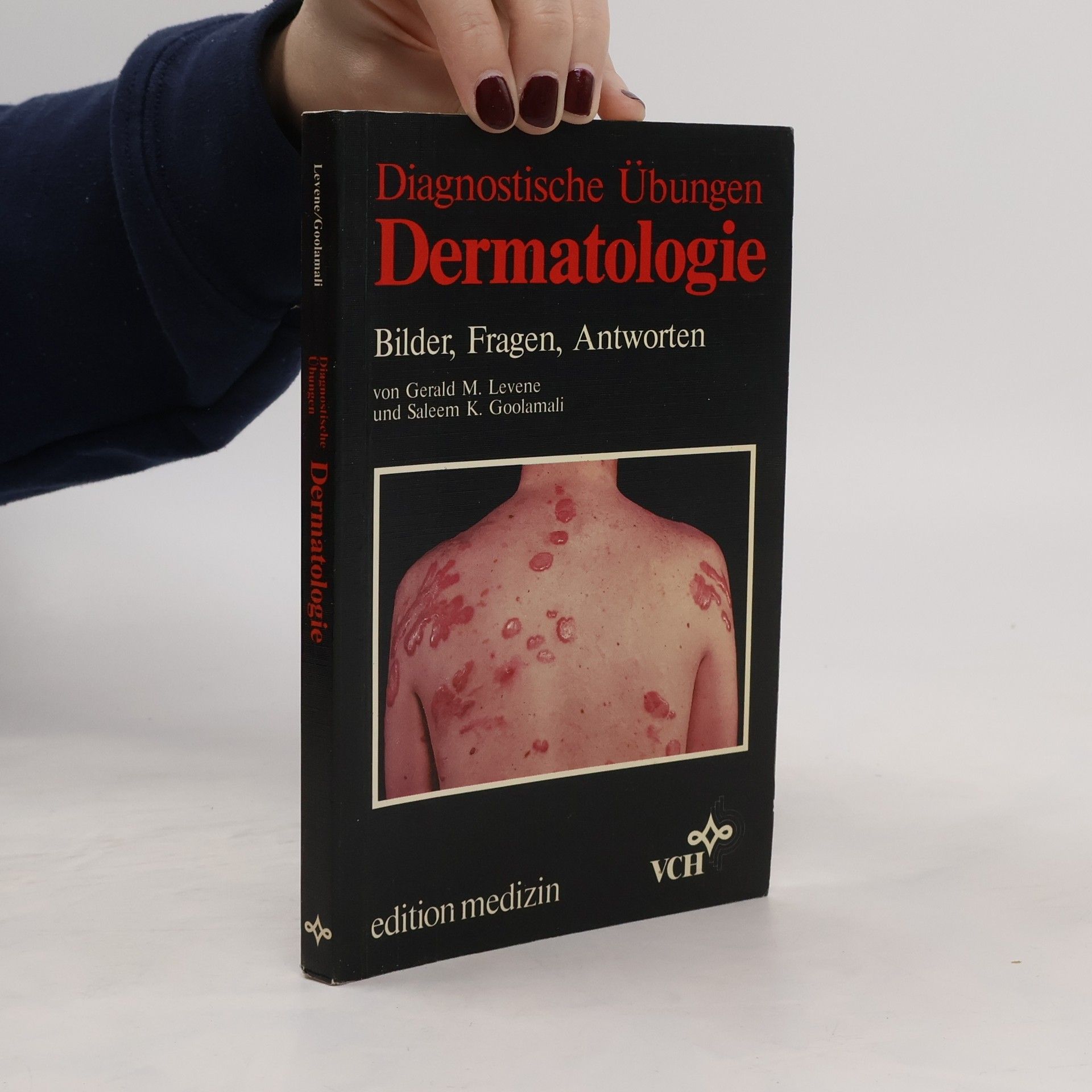 Gerald M. Levene Diagnostische Übungen Dermatologie