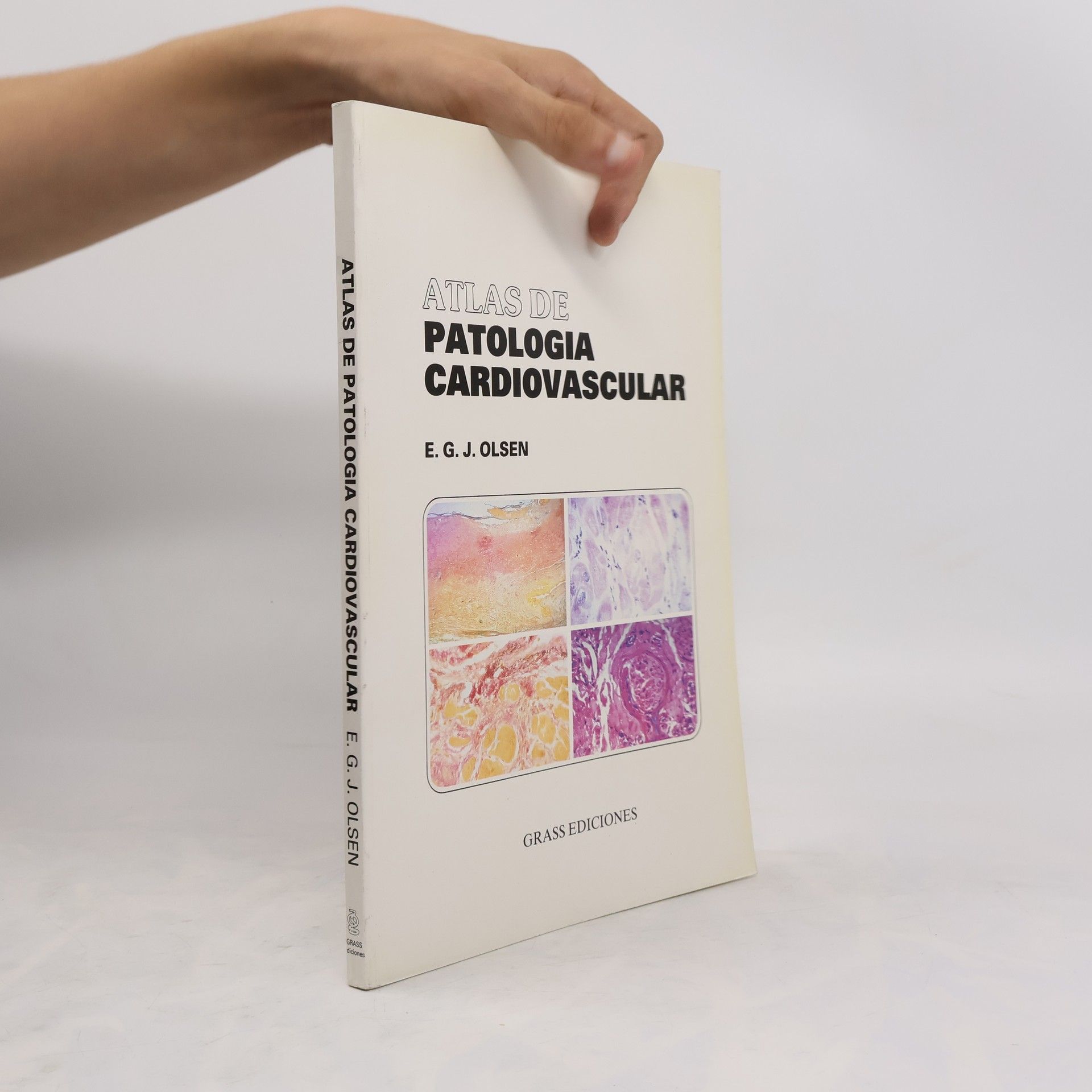 Eckhardt G. J. Olsen Atlas de patología cardiovascular
