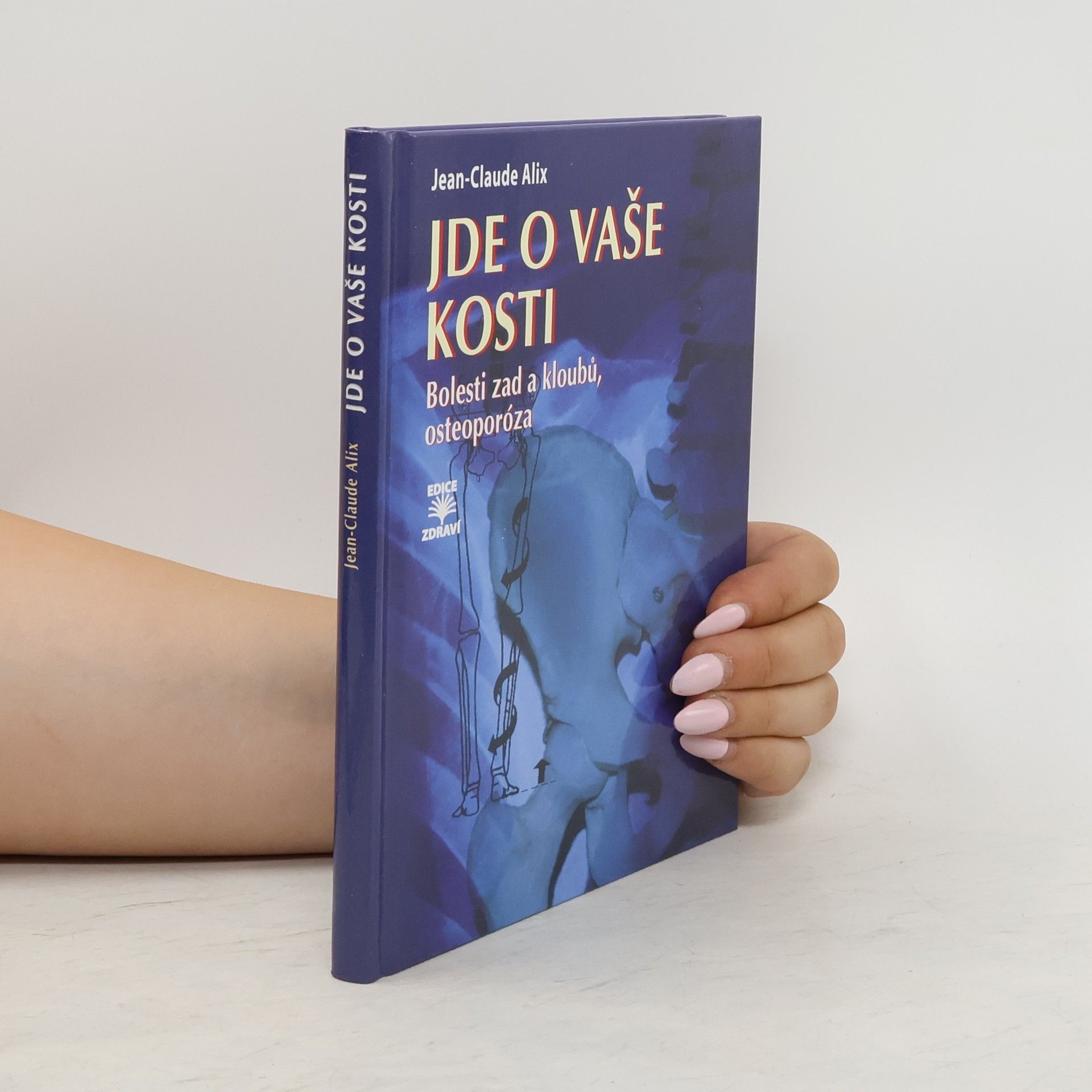 Jean-Claude Alix Jde o vaše kosti : bolesti zad a kloubů, osteoporóza