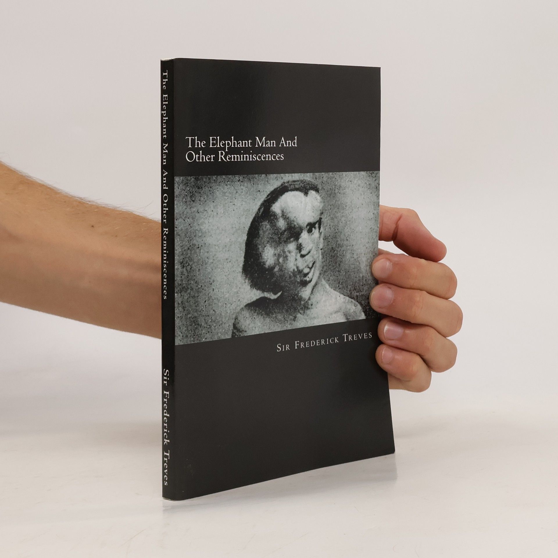 Frederick Treves The Elephant Man and Other Reminiscences