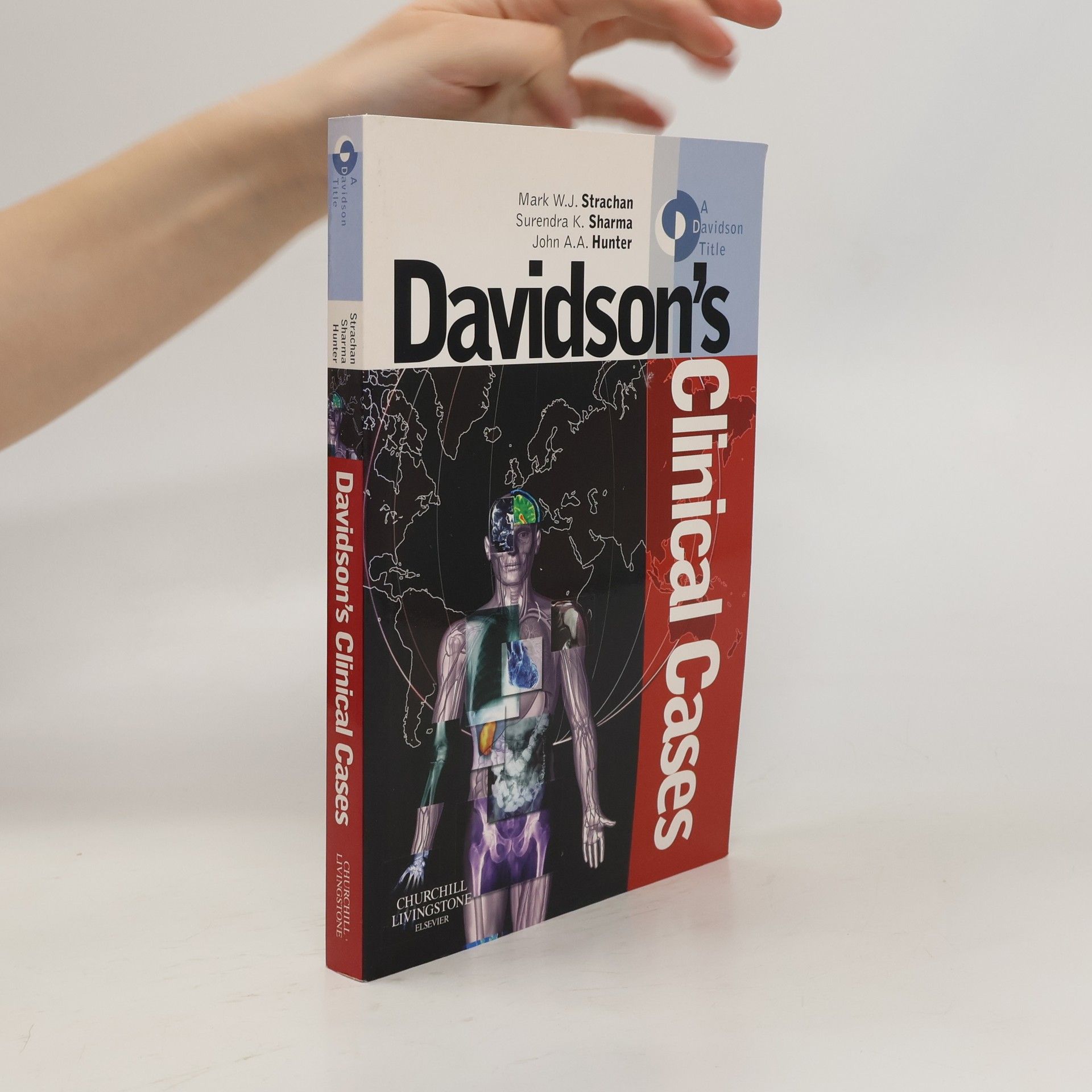 Mark W. J. Strachan Davidson's Clinical Cases