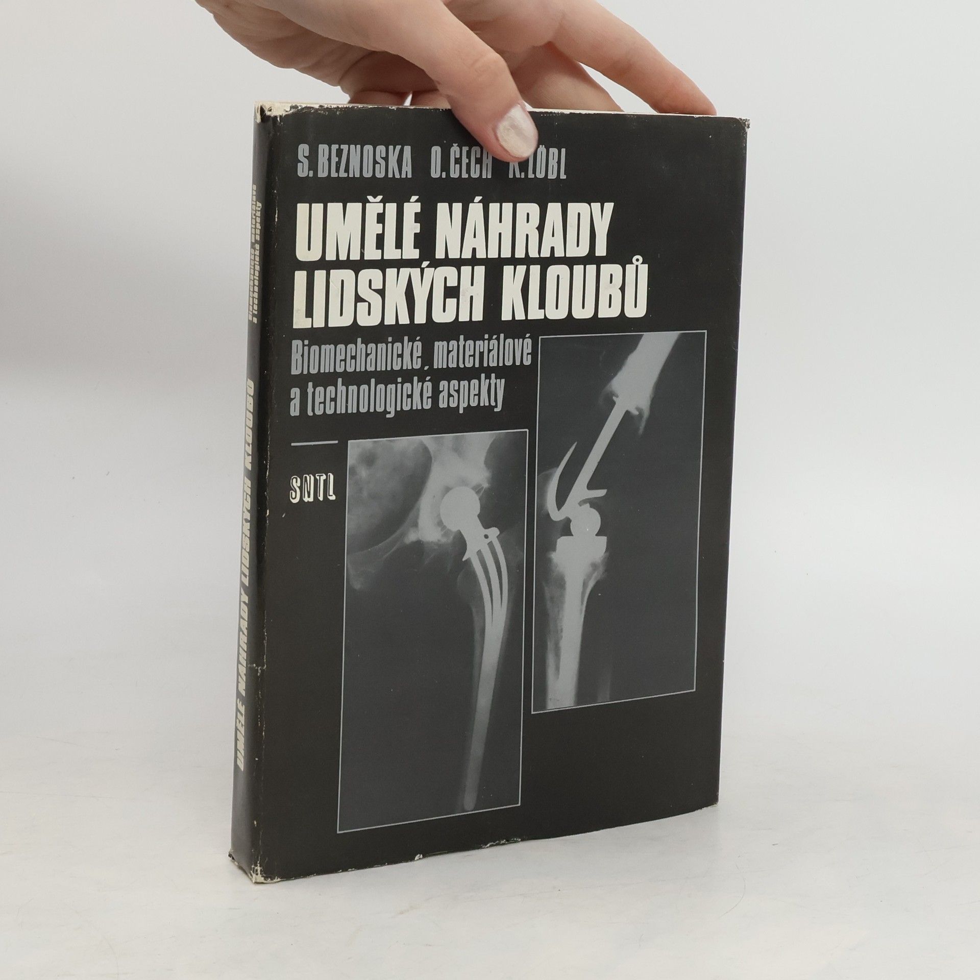 Löbl Umělé náhrady lidských kloubů : Biomechanické, materiálové a technologické aspekty
