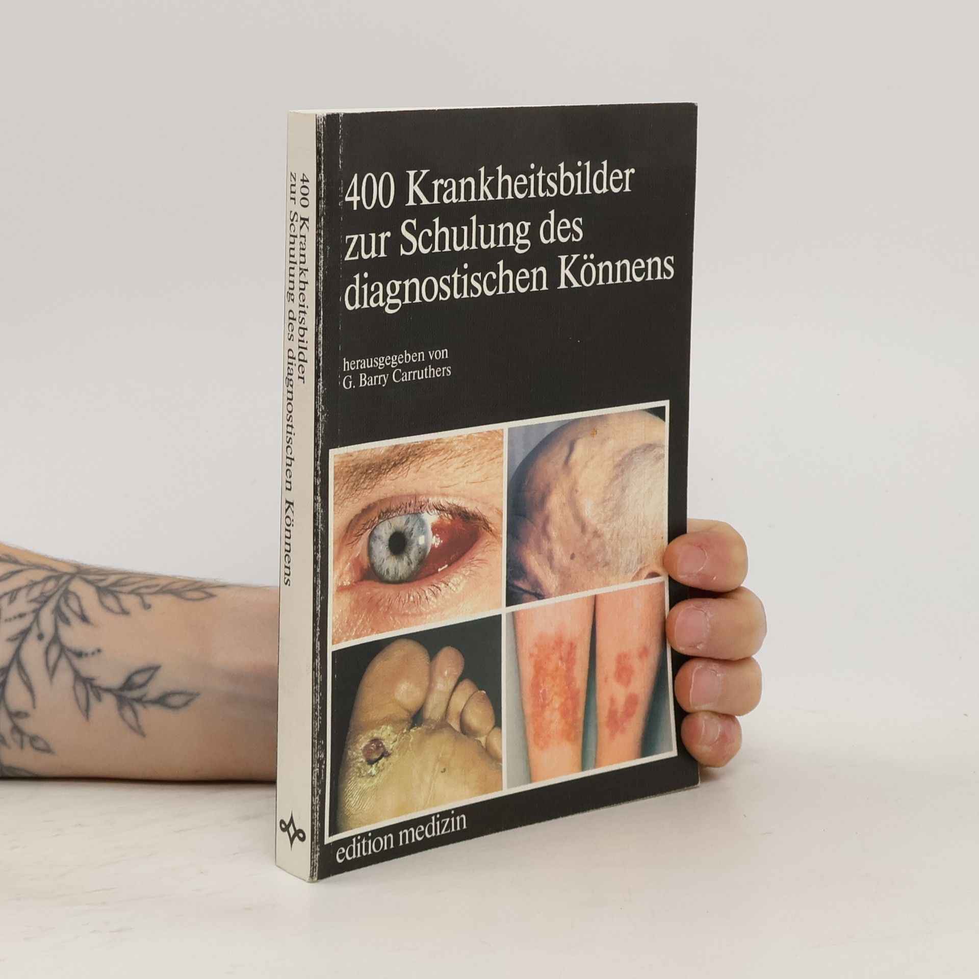 G. Barry Carruthers 400 [Vierhundert] Krankheitsbilder zur Schulung des diagnostischen Könnens