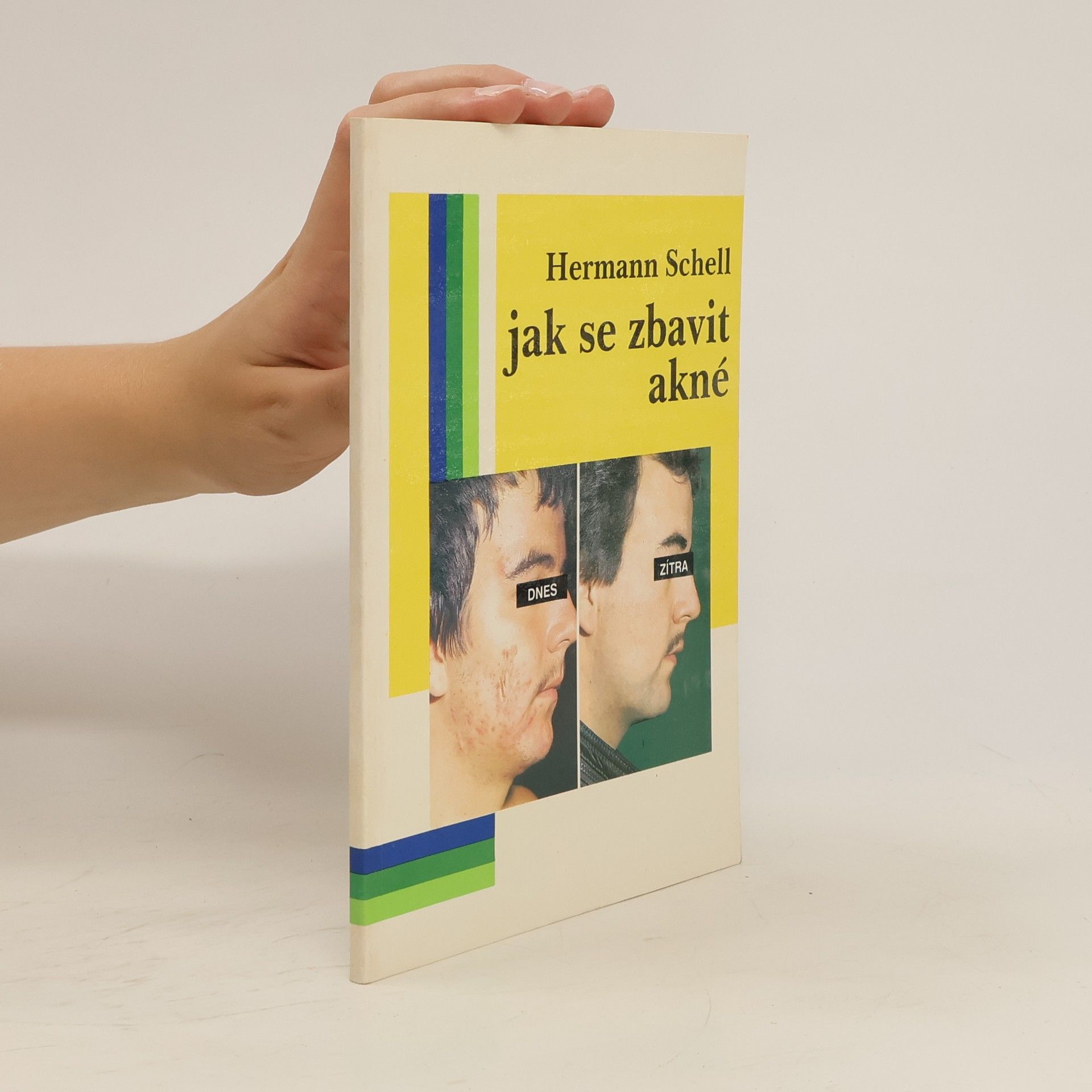 Hermann Schell Jak se zbavit akné