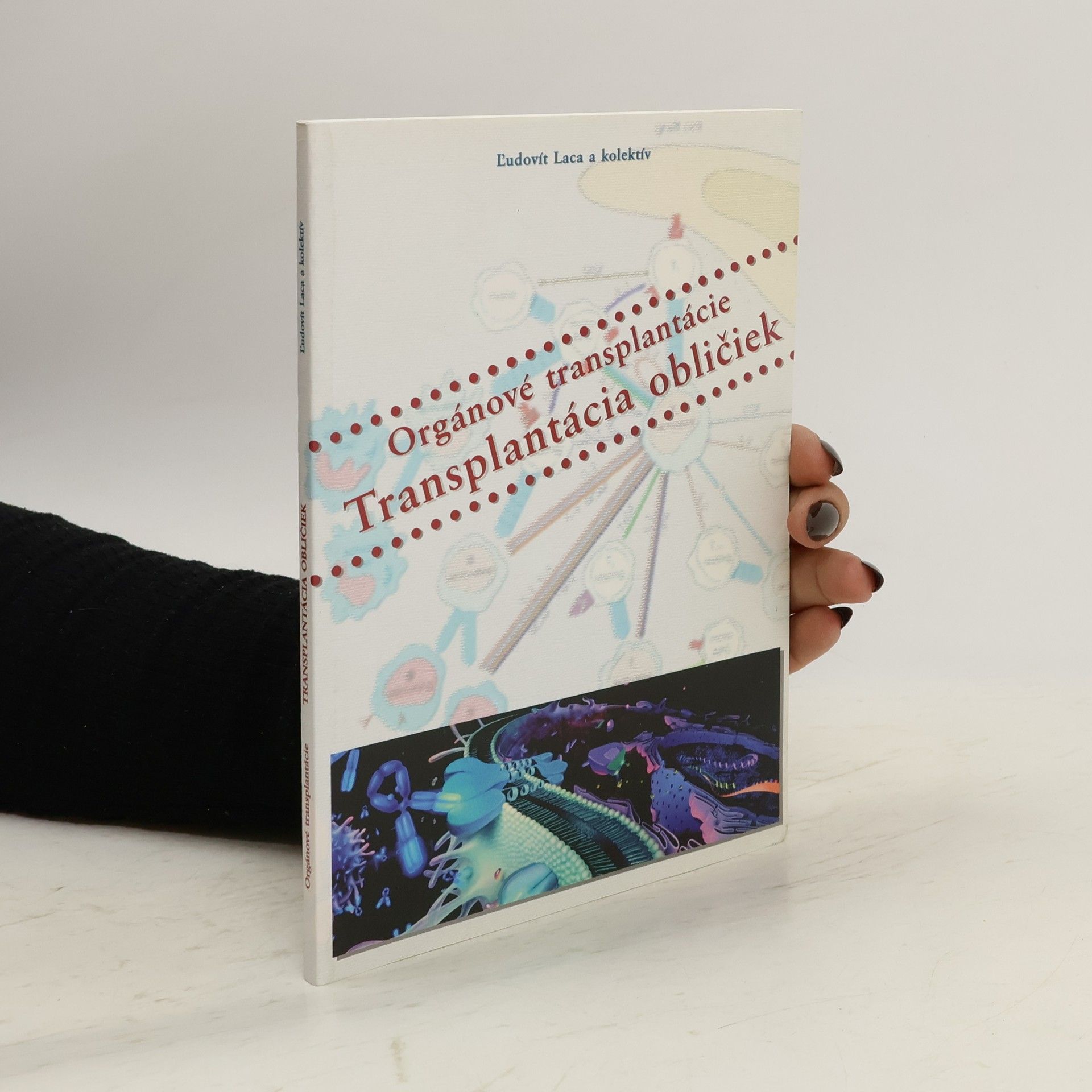 Autorenkollektiv Orgánové transplantácie - Transplantácie obličiek