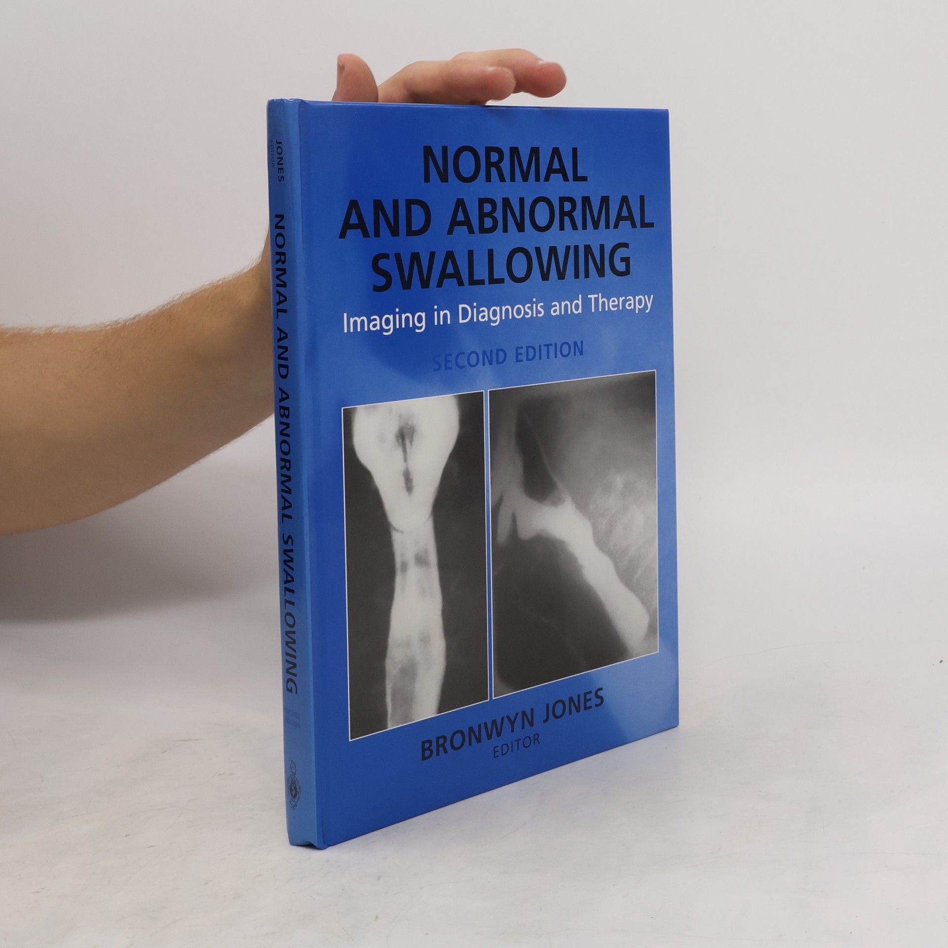 Jones Bronwyn Normal and abnormal swallowing