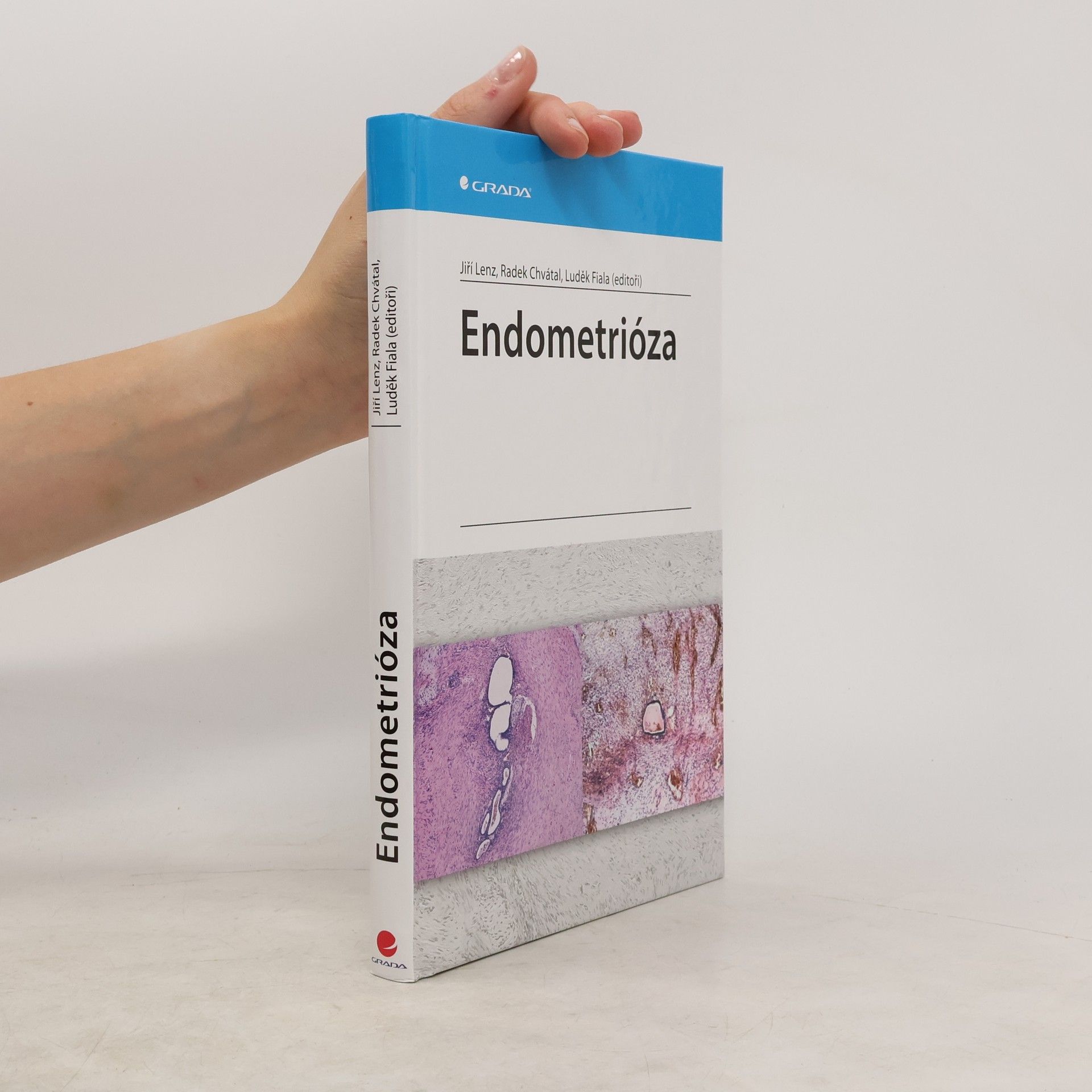 Jiří Lenz Endometrióza